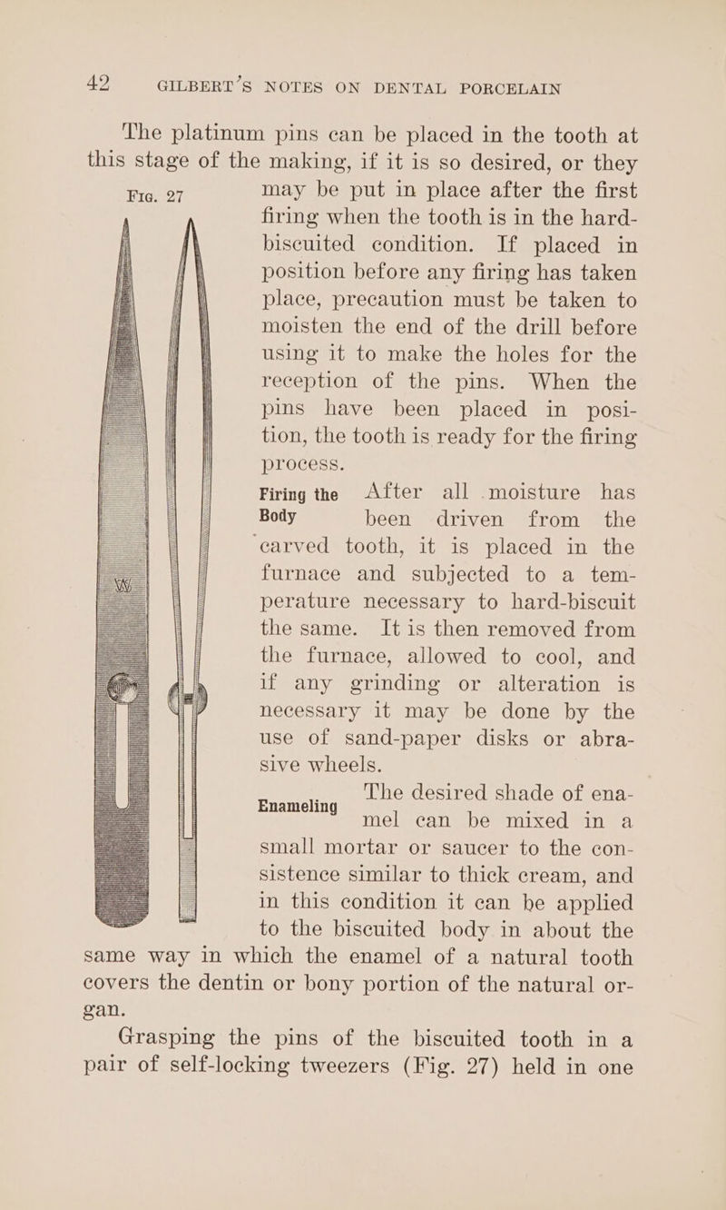 Lhe platinum pins can be placed in the tooth at this stage of the making, if it is so desired, or they Fre. 27 may be put in place after the first firing when the tooth is in the hard- biscuited condition. If placed in position before any firing has taken place, precaution must be taken to moisten the end of the drill before using it to make the holes for the reception of the pins. When the pins have been placed in _ posi- tion, the tooth is ready for the firing process. Firing the After all moisture has Body been driven from _ the ‘earved tooth, it is placed in the furnace and subjected to a tem- perature necessary to hard-biscuit the same. It is then removed from the furnace, allowed to cool, and if any grinding or alteration is necessary it may be done by the use of sand-paper disks or abra- Sive wheels. The desired shade of ena- mel can be mixed in a small mortar or saucer to the con- sistence similar to thick cream, and in this condition it ean be applied to the biscuited body in about the same way in which the enamel of a natural tooth covers the dentin or bony portion of the natural or- gan. Grasping the pins of the biscuited tooth in a pair of self-locking tweezers (Fig. 27) held in one Meet a Enameling il un