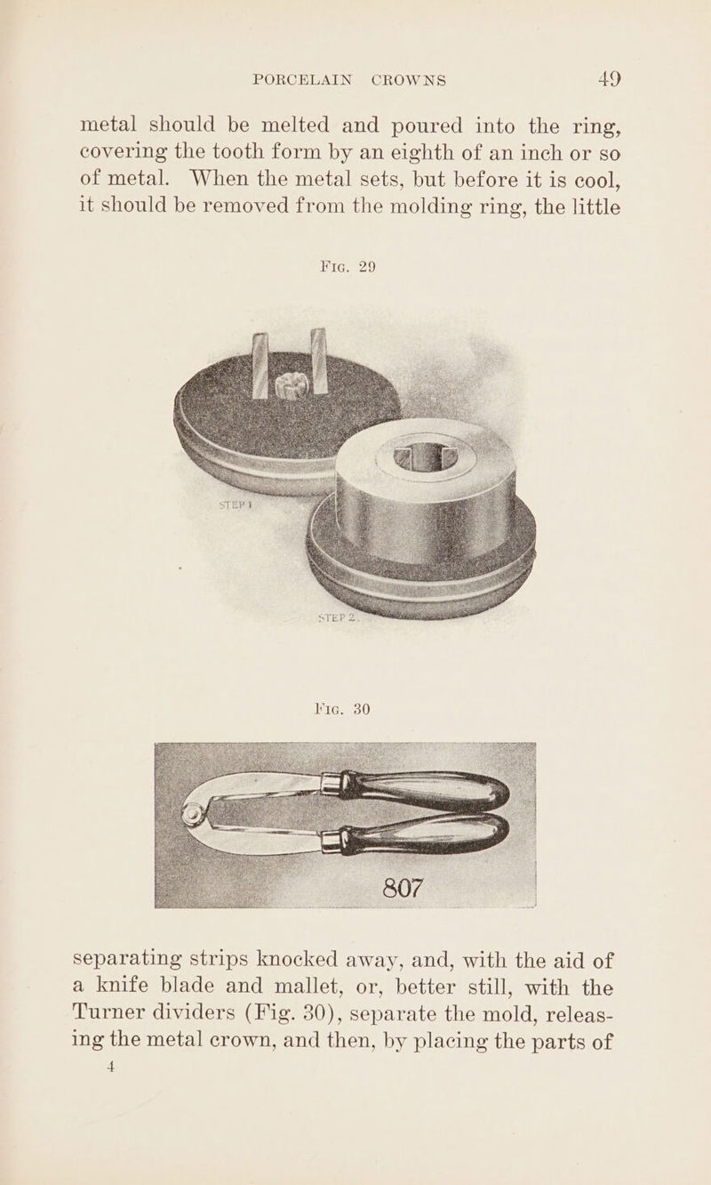 metal should be melted and poured into the ring, covering the tooth form by an eighth of an inch or so of metal. When the metal sets, but before it is cool, it should be removed from the molding ring, the little l'Ic. 30 separating strips knocked away, and, with the aid of a knife blade and mallet, or, better still, with the Turner dividers (Fig. 30), separate the mold, releas- ing the metal crown, and then, by placing the parts of 4