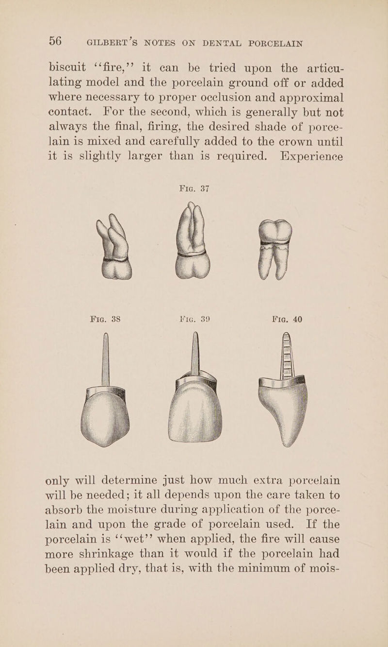 biscuit ‘‘fire,’’ it can be tried upon the articu- lating model and the porcelain ground off or added where necessary to proper occlusion and approximal contact. For the second, which is generally but not always the final, firing, the desired shade of porce- lain is mixed and carefully added to the crown until it is slightly larger than is required. Experience only will determine just how much extra porcelain will be needed; it all depends upon the care taken to absorb the moisture during application of the porce- lain and upon the grade of porcelain used. If the porcelain is ‘‘wet’’ when applied, the fire will cause more shrinkage than it would if the porcelain had been applied dry, that is, with the minimum of mois-