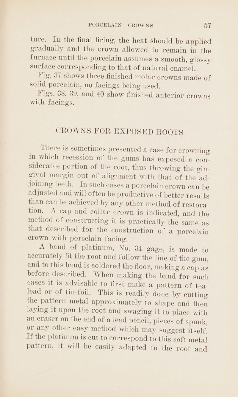 ture. In the final firing, the heat should be applied gradually and the crown allowed to remain in the furnace until the porcelain assumes a smooth, glossy surface corresponding to that of natural enamel. Pig. 37 shows three finished molar crowns made of solid porcelain, no facings being used. Figs. 38, 39, and 40 show finished anterior crowns with facings. CROWNS FOR EXPOSED ROOTS There is sometimes presented a case for crowning in which recession of the gums has exposed a con- siderable portion of the root, thus throwing the gin- gival margin out of alignment with that of the ad- Joining teeth. In such cases a porcelain crown can be adjusted and will often be productive of better results than can be achieved by any other method of restora- tion. A cap and collar crown is indicated, and the method of constructing it is practically the same as that described for the construction of a porcelain crown with porcelain facing. A band of platinum, No. 34 gage, 1s made to accurately fit the root and follow the line of the gum, and to this band is soldered the floor, making a cap as before described. When making the band for such cases it is advisable to first make a Davlerneot teas lead or of tin-foil. This is readily done by cutting the pattern metal approximately to shape and then laying it upon the root and Swaging it to place with an eraser on the end of a lead pencil, pieces of spunk, or any other easy method which may suggest itself. If the platinum is cut to correspond to this soft metal pattern, it will be easily adapted to the root and