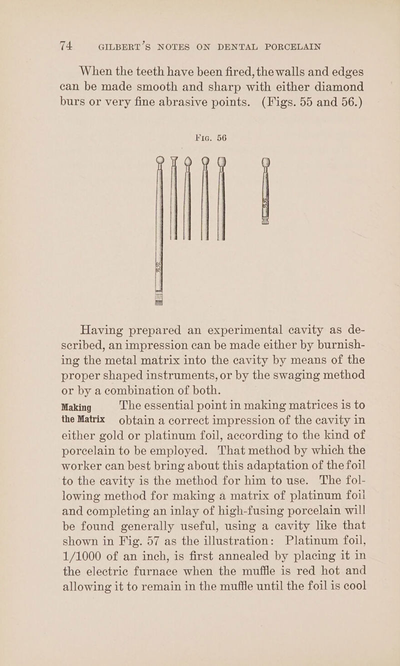 When the teeth have been fired, the walls and edges can be made smooth and sharp with either diamond burs or very fine abrasive points. (Figs. 55 and 56.) My iy =| =| ay Having prepared an experimental cavity as de- scribed, an impression can be made either by burnish- ing the metal matrix into the cavity by means of the proper shaped instruments, or by the swaging method or by a combination of both. Making The essential point in making matrices is to the Matrix obtain a correct impression of the cavity in either gold or platinum foil, according to the kind of porcelain to be employed. That method by which the worker can best bring about this adaptation of the foil to the cavity is the method for him to use. The fol- lowing method for making a matrix of platinum foul and completing an inlay of high-fusing porcelain will be found generally useful, using a cavity like that shown in Fig. 57 as the illustration: Platinum foil, 1/1000 of an inch, is first annealed by placing it in the electric furnace when the muffle is red hot and allowing it to remain in the muffle until the foil is cool