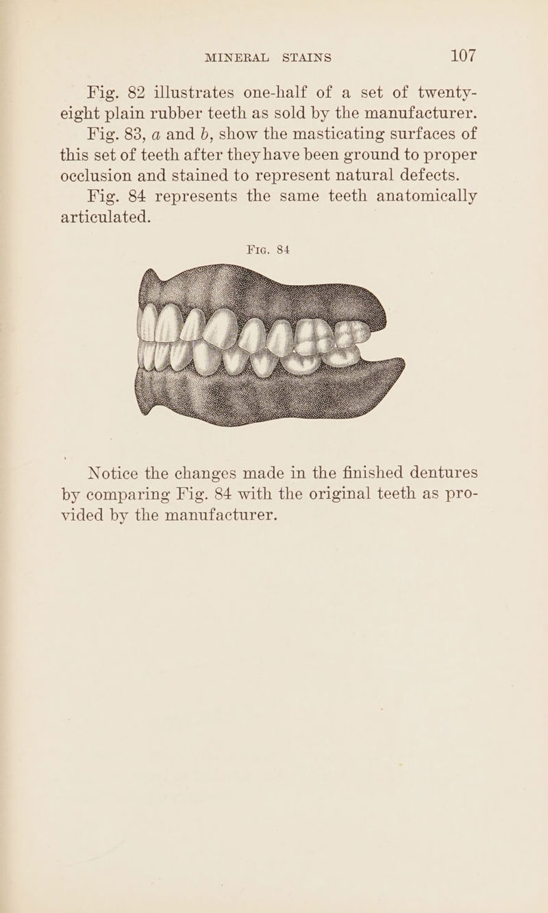 Fig. 82 illustrates one-half of a set of twenty- eight plain rubber teeth as sold by the manufacturer. Fig. 83, a and b, show the masticating surfaces of this set of teeth after they have been ground to proper occlusion and stained to represent natural defects. Fig. 84 represents the same teeth anatomically articulated. Notice the changes made in the finished dentures by comparing Fig. 84 with the original teeth as pro- vided by the manufacturer.