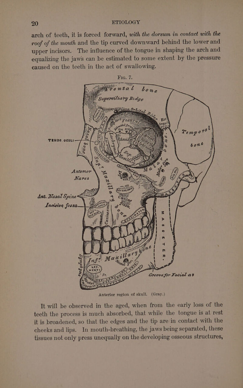 arch of teeth, it is forced forward, with the dorsum in contact with the roof of the mouth and the tip curved downward behind the lower and upper incisors. The influence of the tongue in shaping the arch and equalizing the jaws can be estimated to some extent by the pressure caused on the teeth in the act of swallowing. MEG: oes wT fe ht eka eae i Yo mta b lone Supaneiliairy Ridge \ WARS SU TENDO. OCULI . e a° vi) ea veo? t ° 4 MATEY TI) Ant. Nasal Spine &lt; Inoisive fossa Se ey It will be observed in the aged, when from the early loss of the teeth the process is much absorbed, that while the tongue is at rest it is broadened, so that the edges and the tip are in contact with the cheeks and lips. In mouth-breathing, the jaws being separated, these tissues not only press unequally on the developing osseous structures,