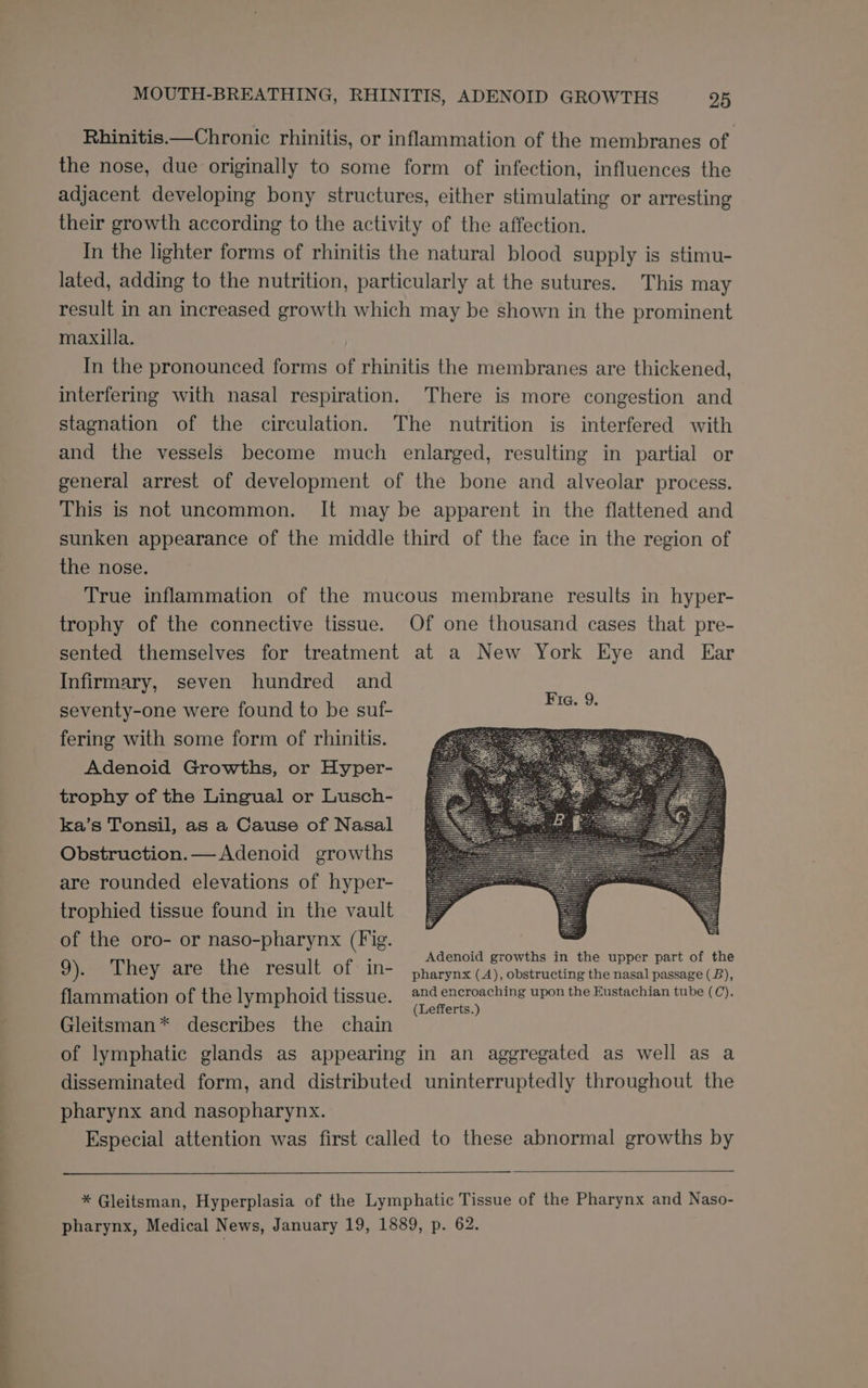 ——— Rhinitis.—Chronic rhinitis, or inflammation of the membranes of ; the nose, due originally to some form of infection, influences the adjacent developing bony structures, either stimulating or arresting their growth according to the activity of the affection. In the lighter forms of rhinitis the natural blood supply is stimu- lated, adding to the nutrition, particularly at the sutures. This may result in an increased growth which may be shown in the prominent maxilla. In the pronounced forms of rhinitis the membranes are thickened, interfering with nasal respiration. There is more congestion and stagnation of the circulation. The nutrition is interfered with and the vessels become much enlarged, resulting in partial or general arrest of development of the bone and alveolar process. This is not uncommon. It may be apparent in the flattened and sunken appearance of the middle third of the face in the region of the nose. True inflammation of the mucous membrane results in hyper- trophy of the connective tissue. Of one thousand cases that pre- sented themselves for treatment at a New York Eye and Ear Infirmary, seven hundred and seventy-one were found to be suf- fering with some form of rhinitis. Adenoid Growths, or Hyper- trophy of the Lingual or Lusch- ka’s Tonsil, as a Cause of Nasal Obstruction.— Adenoid growths are rounded elevations of hyper- trophied tissue found in the vault of the oro- or naso-pharynx (Fig. Adenoid growths in the upper part of the 9). They are the result of in- pharynx (A), obstructing the nasal passage (B), flammation of the lymphoid tissue. fee ne ne ee ete ee Dies Cee Ce Gleitsman* describes the chain of lymphatic glands as appearing in an aggregated as well as a disseminated form, and distributed uninterruptedly throughout the pharynx and nasopharynx. Especial attention was first called to these abnormal growths by * Gleitsman, Hyperplasia of the Lymphatic Tissue of the Pharynx and Naso- pharynx, Medical News, January 19, 1889, p. 62.