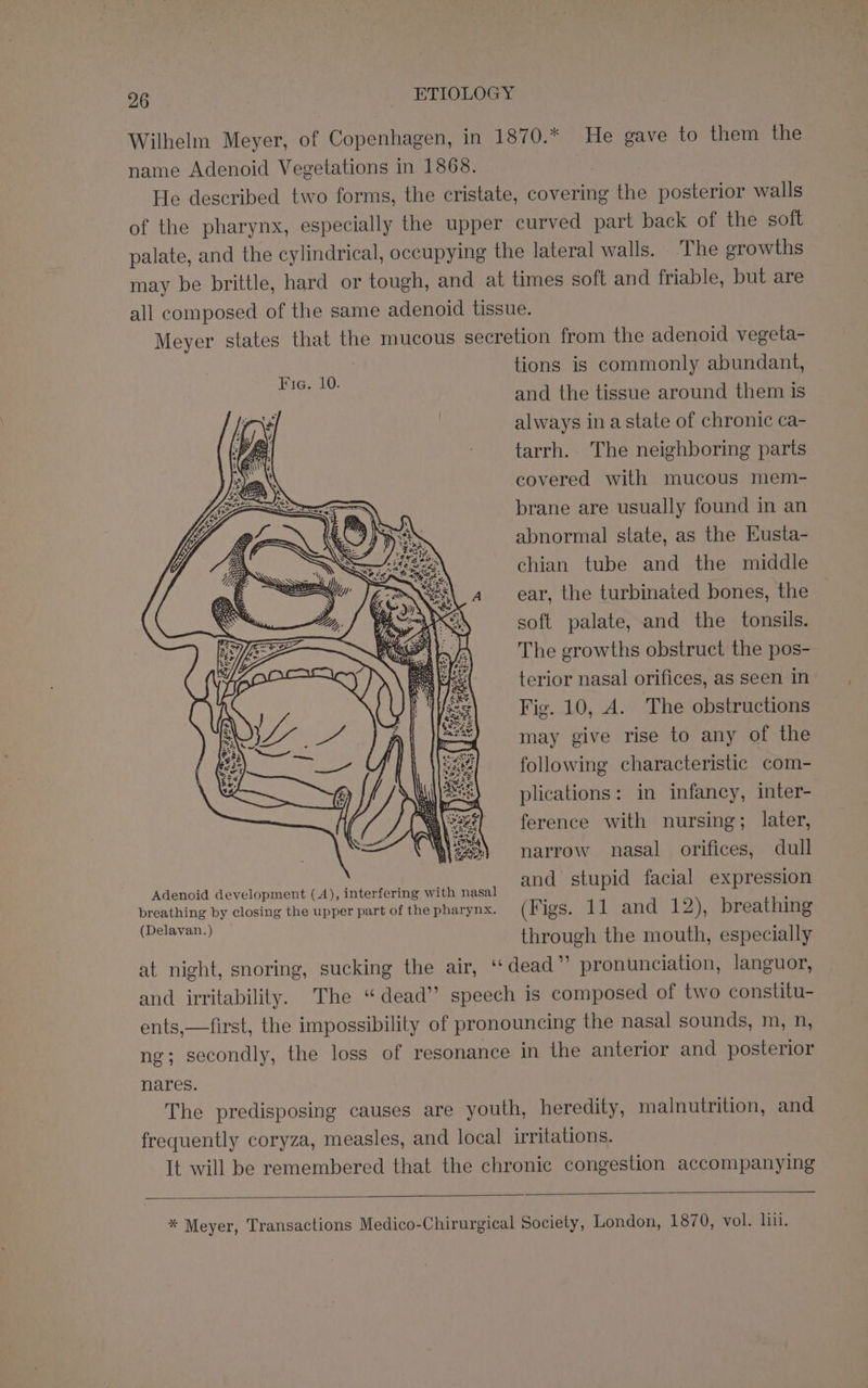 Wilhelm Meyer, of Copenhagen, in 1870.* He gave to them the name Adenoid Vegetations in 1868. | He described two forms, the cristate, covering the posterior walls of the pharynx, especially the upper curved part back of the soft palate, and the cylindrical, occupying the lateral walls. The growths may be brittle, hard or tough, and at times soft and friable, but are all composed of the same adenoid tissue. Meyer states that the mucous secretion from the adenoid vegeta- tions is commonly abundant, and the tissue around them is always inastate of chronic ca- tarrh. The neighboring parts covered with mucous mem- brane are usually found in an abnormal state, as the Eusta- chian tube and the middle ear, the turbinated bones, the soft palate, and the tonsils. The growths obstruct the pos- terior nasal orifices, as seen in Fig. 10, A. The obstructions may give rise to any of the following characteristic com- plications: in infancy, inter- ference with nursing; later, narrow nasal orifices, dull and stupid facial expression Adenoid development (A), interfering with nasal / ‘ breathing by closing the upper part of the pharynx. (Figs. Ta and 1 2), breathing Shae aie through the mouth, especially at night, snoring, sucking the air, ‘‘ dead” pronunciation, languor, and irritability. The “dead” speech is composed of two constitu- ents,—first, the impossibility of pronouncing the nasal sounds, m, n, ng; secondly, the loss of resonance in the anterior and posterior nares. The predisposing causes are youth, heredity, malnutrition, and frequently coryza, measles, and local irritations. It will be remembered that the chronic congestion accompanying * Meyer, Transactions Medico-Chirurgical Society, London, 1870, vol. liu.