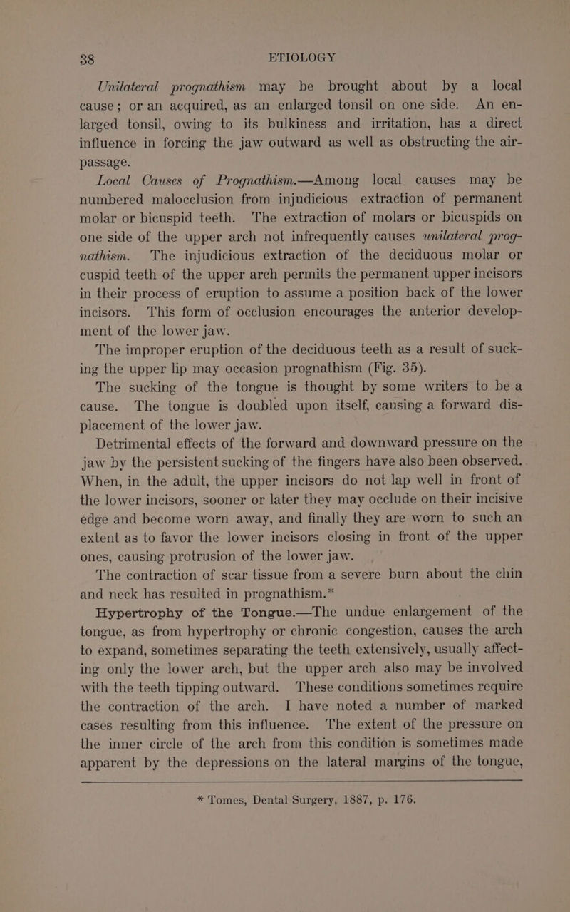 Unilateral prognathism may be brought about by a_ local cause; or an acquired, as an enlarged tonsil on one side. An en- larged tonsil, owing to its bulkiness and irritation, has a direct influence in forcing the jaw outward as well as obstructing the air- passage. Local Causes of Prognathism.—Among local causes may be numbered malocclusion from injudicious extraction of permanent molar or bicuspid teeth. The extraction of molars or bicuspids on one side of the upper arch not infrequently causes unilateral prog- nathism. The injudicious extraction of the deciduous molar or cuspid teeth of the upper arch permits the permanent upper incisors in their process of eruption to assume a position back of the lower incisors. This form of occlusion encourages the anterior develop- ment of the lower jaw. The improper eruption of the deciduous teeth as a result of suck- ing the upper lip may occasion prognathism (Fig. 35). The sucking of the tongue is thought by some writers to bea cause. The tongue is doubled upon itself, causing a forward dis- placement of the lower jaw. Detrimental effects of the forward and downward pressure on the jaw by the persistent sucking of the fingers have also been observed. When, in the adult, the upper incisors do not lap well in front of the lower incisors, sooner or later they may occlude on their incisive edge and become worn away, and finally they are worn to such an extent as to favor the lower incisors closing in front of the upper ones, causing protrusion of the lower jaw. The contraction of scar tissue from a severe burn about the chin and neck has resulted in prognathism.* Hypertrophy of the Tongue.—The undue han eiiee of the tongue, as from hypertrophy or chronic congestion, causes the arch to expand, sometimes separating the teeth extensively, usually affect- ing only the lower arch, but the upper arch also may be involved with the teeth tipping outward. These conditions sometimes require the contraction of the arch. I have noted a number of marked cases resulting from this influence. The extent of the pressure on the inner circle of the arch from this condition is sometimes made apparent by the depressions on the lateral margins of the tongue, * Tomes, Dental Surgery, 1887, p. 176.