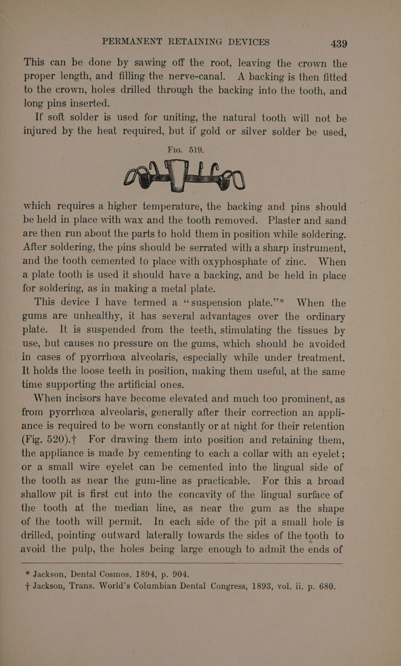 This can be done by sawing off the root, leaving the crown the proper length, and filling the nerve-canal. A backing is then fitted to the crown, holes drilled through the backing into the tooth, and long pins inserted. If soft solder is used for uniting, the natural tooth will not be injured by the heat required, but if gold or silver solder be used, which requires a higher temperature, the backing and pins should be held in place with wax and the tooth removed. Plaster and sand are then run about the parts to hold them in position while soldering. After soldering, the pins should be serrated with a sharp instrument, and the tooth cemented to place with oxyphosphate of zinc. When a plate tooth is used it should have a backing, and be held in place for soldering, as in making a metal plate. This device I have termed a ‘suspension plate.”* When the gums are unhealthy, it has several advantages over the ordinary plate. It is suspended from the teeth, stimulating the tissues by use, but causes no pressure on the gums, which should be avoided in cases of pyorrhcea alveolaris, especially while under treatment. It holds the loose teeth in position, making them useful, at the same time supporting the artificial ones. ; When incisors have become elevated and much too prominent, as from pyorrhcea alveolaris, generally after their correction an appli- ance is required to be worn constantly or at night for their retention (Fig. 520).f For drawing them into position and retaining them, the appliance is made by cementing to each a collar with an eyelet ; or a small wire eyelet can be cemented into the lingual side of the tooth as near the gum-line as practicable. For this a broad shallow pit is first cut into the concavity of the lingual surface of the tooth at the median line, as near the gum as the shape of the tooth will permit. In each side of the pit a small hole is drilled, pointing outward laterally towards the sides of the tooth to avoid the pulp, the holes being large enough to admit the ends of * Jackson, Dental Cosmos, 1894, p. 904. + Jackson, Trans. World’s Columbian Dental Congress, 1893, vol. ii. p. 680.