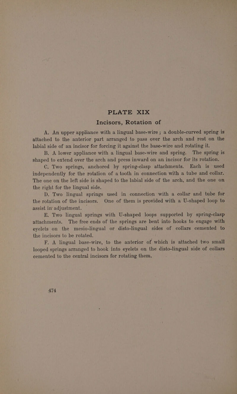 Incisors, Rotation of A. An upper appliance with a lingual base-wire ; a double-curved spring is attached to the anterior part arranged to pass over the arch and rest on the labial side of an incisor for forcing it against the base-wire and rotating it. B. A lower appliance with a lingual base-wire and spring. The spring is shaped to extend over the arch and press inward on an incisor for its rotation. C. Two springs, anchored by spring-clasp attachments. Each is used independently for the rotation of a tooth in connection with a tube and collar. The one on the left side is shaped to the labial side of the arch, and the one on the right for the lingual side. D. Two lingual springs used in connection with a collar and tube for the rotation of the incisors. One of them is provided with a U-shaped loop to assist in' adjustment. — : Ek. Two lingual springs with U-shaped loops supported by spring-clasp attachments. The free ends of the springs are bent into hooks to engage with eyelets on the mesio-lingual or disto-lingual sides of collars cemented to the incisors to be rotated. F. A lingual base-wire, to the anterior of which is attached two small looped springs arranged to hook into eyelets on the disto-lingual side of collars cemented to the central incisors for rotating them. 474