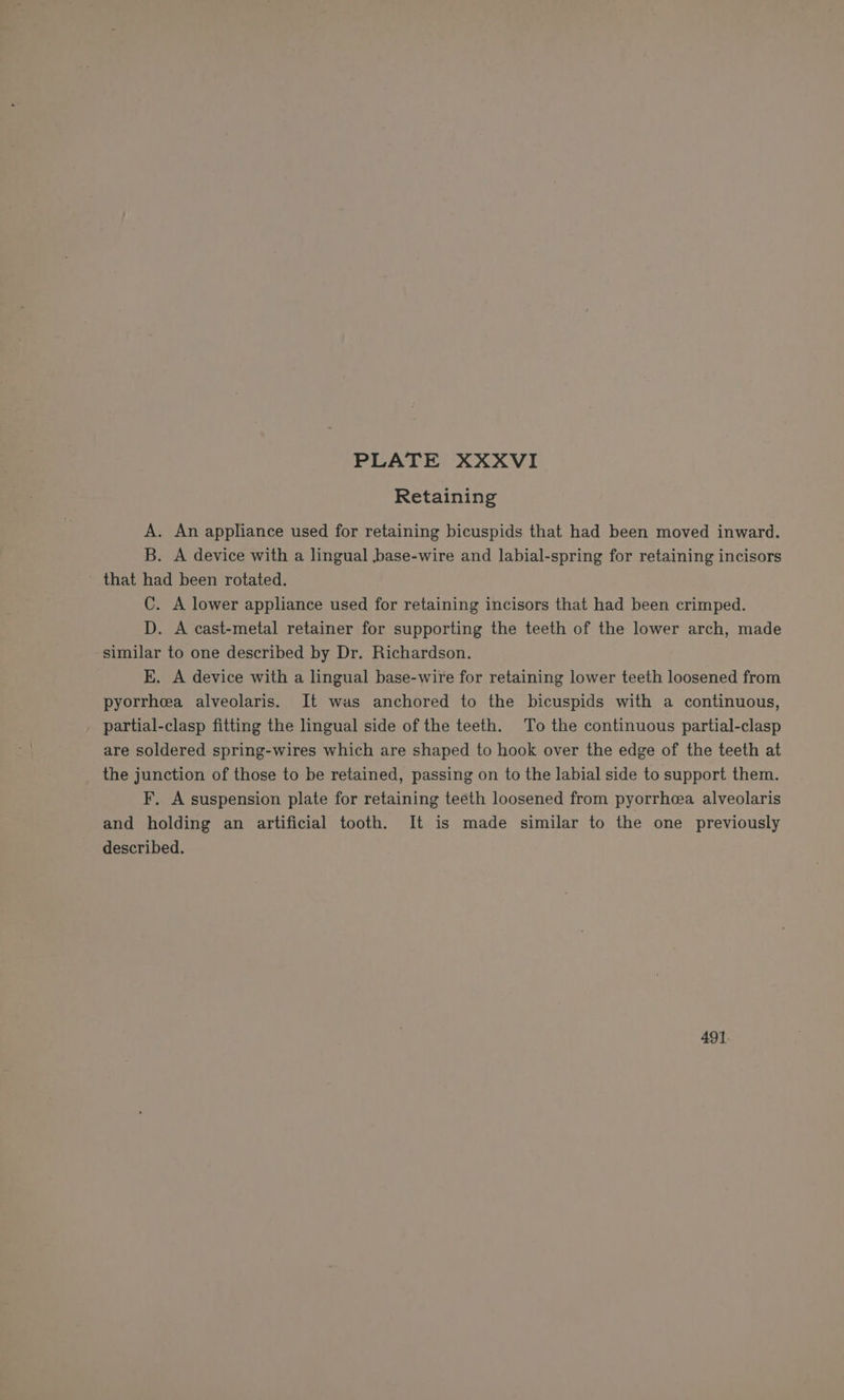 Retaining A. An appliance used for retaining bicuspids that had been moved inward. B. A device with a lingual base-wire and labial-spring for retaining incisors that had been rotated. C. A lower appliance used for retaining incisors that had been crimped. D. A cast-metal retainer for supporting the teeth of the lower arch, made similar to one described by Dr. Richardson. E. A device with a lingual base-wire for retaining lower teeth loosened from pyorrhea alveolaris. It was anchored to the bicuspids with a continuous, partial-clasp fitting the lingual side of the teeth. To the continuous partial-clasp are soldered spring-wires which are shaped to hook over the edge of the teeth at the junction of those to be retained, passing on to the labial side to support them. F. A suspension plate for retaining teeth loosened from pyorrheea alveolaris and holding an artificial tooth. It is made similar to the one previously described. 491.
