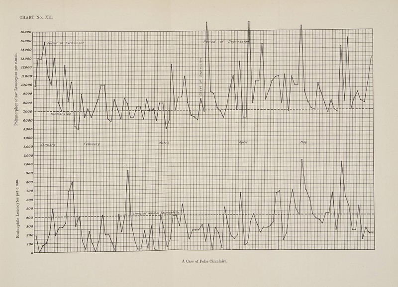 ate mag Danas ie i ra tr i H ce 750001 1Til edo [oF Exc EEE BERDEERGE SG Bue ann che Abba [oF |DE nono CAEL EE EEEEEEE EEE ECEE CEES Peres MRI mel (| au aeOuE buBe BH lelals | slaseaallg oH rAWUBIEIN PIL chalet UIE Vel mccd | al eke lacie slit ope toa a I cimtn nti [es |e Perel S| acer alae (CLUE 1G (EO ne ae EOD: NBR EE Bee SS a0 IGORBEOL alae falelelattelala ECECCC NT it ale 5000}- 4000 von (WE a isle sooo | a PPE up SELauataaE sooo FETT Aa ETAEREESEEE F AG me EEC CEH ECE 800 HUGBESCCe A Techeoul soace BE claire Wohat: batalla a POOP CHun Og dae ae ces wBebe Be OE Cee eee PBEo 700 FP RSECCC CWE HES Cie BERS Uo ROP Seo OCC Laos ese Ree anes ve EEE EERE RECEP CPA CLAP TEPPER j i ( } R h i Vana \ \ tad BCC CPCCA BEUCRUERBRCEBOONCRa ote : CLEP OLE BROS Eeuea 100 See UeETOSMUGAYALUANGELT SEBEGLET SLED Vana PCECEEERE AEE EE Ei : BRERELOEL PATE ELSE MLE ES ld 2 Seeeeeeee rey A Case of Folie Circulaire.