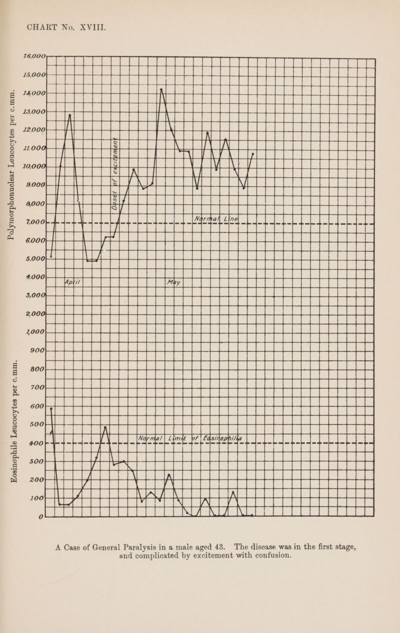 Eosinophile Leucocytes per c.mm. CHART No. XVIII. I6,00 og el ek an Zee ‘om Be BeGeee ie ae 16000} CEE EEE eae Oe Pe ieee ioe ht bt backache ees Se eee om el i er dk ae aay ne PAVUSASAVE Ih LA eee ESA SESE Satesennae pur areator gon teestoaeatectecatootoats aoe eerie a noe ne ae “Se eehe AcnVevartacneEee ee 58 eae PEE CEE EE EEE HE HH 4 + Seer eee eee do ee eh ie cae nooo ie Cooney FP ic) pd) to Lome ee ee eet ioe foe dal ee a i went aed) i tice pede ie novo Pace a ASV ES RRS 2 Ree See eke jemi La peter a oil w S$ i) Ei eS a ie im | PS ewe anaes neps ma ee ScSnSa uni a A Case of General Paralysis in a male aged 43. The disease was in the first stage, and complicated by excitement with confusion.