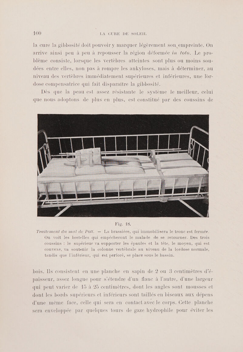 la cure la g1bbosité doit pouvoir y marquer légèrement son empreinte. On arrive ainsi peu à peu à repousser la région déformée in toto. Le pro- blème consiste, lorsque les vertèbres atteintes sont plus où moins sou- dées entre elles, non pas à rompre les ankyloses, mais à déterminer, au niveau «les vertèbres immédiatement supérieures et inférieures, une lor- dose compensatrice qui fait disparaitre la o1bbosité. Dès que la peau est assez résistante le système le meilleur, celui que nous adoptons de plus en plus, est constitué par des coussins de PI SSELS: Traitement du nat de Poll. — La brassière, qui immobilisera le tronc est fermée. On voit les bretelles qui empêcheront le malade de se retourner. Des trois coussins : le supérieur va supporter les épaules et la tête, le moyen, qui est convexe, va soutenir la colonne vertébrale au niveau de la lordose normale, tandis que l'inférieur, qui est perforé, se place sous le bassin. bois. IIS consistent en une planche en sapin de 2 ou 3 centimètres d’é- paisseur, assez longue pour s'étendre d’un flanc à l’autre, d'une largeur qui peut varier de 15 à 25 centimètres, dont les angles sont mousses et dont les bords supérieurs et inférieurs sont taillés en biseaux aux dépens d’une même face, celle qui sera en contact avec le corps. Cette planche sera enveloppée par quelques tours de gaze hydrophile pour éviter les