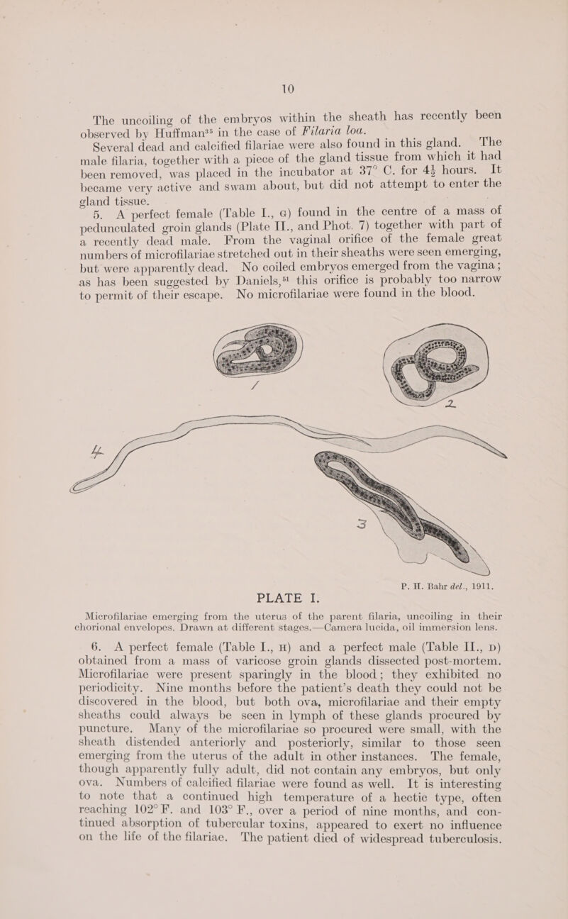The uncoiling of the embryos within the sheath has recently been observed by Huffman®? in the case of Filaria loa. Several dead and calcified filariae were also found in this gland. The male filaria, together with a piece of the gland tissue from which it had been removed, was placed in the incubator at 37° C. for 43 hours. It became very active and swam about, but did not attempt to enter the gland tissue. 5. <A perfect female (Table I., G) found in the centre of a mass of pedunculated groin glands (Plate IT., and Phot. 7) together with part of a recently dead male. From the vaginal orifice of the female great numbers of microfilariae stretched out in their sheaths were seen emerging, but were apparently dead. No coiled embryos emerged from the vagina ; as has been suggested by Daniels, this orifice is probably too narrow to permit of their escape. No microfilariae were found in the blood. \ f _— ao PAH Babridelanl Olle PRALE SI. Microfilariae emerging from the uterus of the parent filaria, uncoiling in their chorional envelopes. Drawn at different stages.—Camera lucida, oil immersion lens. 6. A perfect female (Table I., H) and a perfect male (Table II., p) obtained from a mass of varicose groin glands dissected post-mortem, Microfilariae were present sparingly in the blood; they exhibited no periodicity. Nine months before the patient’s death they could not be discovered in the blood, but both ova, microfilariae and their empty sheaths could always be seen in lymph of these glands procured by puncture. Many of the microfilariae so procured were small, with the sheath distended anteriorly and posteriorly, similar to those seen emerging from the uterus of the adult in other instances. The female though apparently fully adult, did not contain any embryos, but only ova. Numbers of calcified filariae were found as well. It is interesting to note that a continued high temperature of a hectic type often reaching 102° F. and 103° F., over a period of nine months and con- tinued absorption of tubercular toxins, appeared to exert no influence on the life of the filariae. The patient died of widespread tuberculosis.