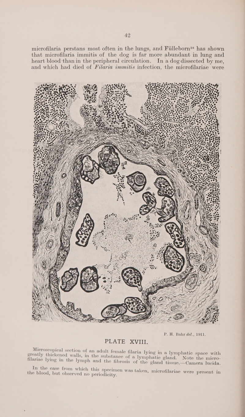 microfilaria perstans most often in the lungs, and Fulleborn** has ee that microfilaria immitis of the dog is far more abundant in ae an heart blood ‘than in the peripheral circulation. In a dog dissected by me, and which had died of Filaria immitis infection, the microfilariae were ® ~s @ e373, y ‘ f H re &amp; “¢ @ ~ AS AY cP ee WV a2. . sees &amp;3 te ay, a At Pte” 2S Wd &lt;4 ©a%2 a6 sole, ‘ WP A eae) i x My BA s4 4 if” Lp ¥ a / aS e,? %. . &gt;= &gt; &lt;a &gt; a Na vas ath as we. ) sod 3 Pum PLATES VILE Microscopical section of an adult female fil greatly thickened walls, in the substance of filariae lying in the lymph and the fibrosis aria lying in a lymphatie space with a lymphatic gland. Note the micro- of the gland tissue.—Camera lucida. In the case from which this specimen was taken, microfilariae were present in the blood, but observed no periodicity.