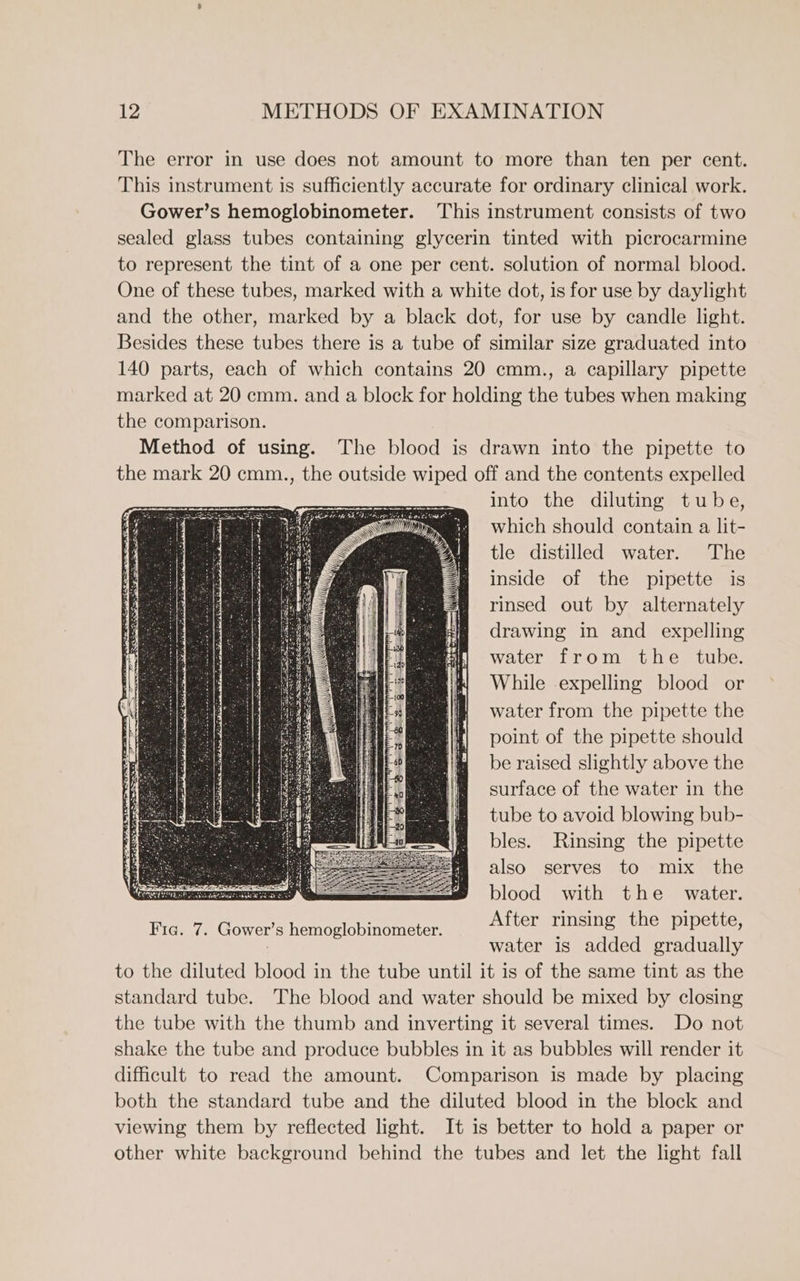 The error in use does not amount to more than ten per cent. This instrument is sufficiently accurate for ordinary clinical work. Gower’s hemoglobinometer. ‘This instrument consists of two sealed glass tubes containing glycerin tinted with picrocarmine to represent the tint of a one per cent. solution of normal blood. One of these tubes, marked with a white dot, is for use by daylight and the other, marked by a black dot, for use by candle light. Besides these tubes there is a tube of similar size graduated into 140 parts, each of which contains 20 cmm., a capillary pipette marked at 20 cmm. and a block for holding the tubes when making the comparison. Method of using. The blood is drawn into the pipette to the mark 20 cmm., the outside wiped off and the contents expelled into the diluting tube, which should contain a lit- tle distilled water. The inside of the pipette is rinsed out by alternately drawing in and expelling water from the tube. While expelling blood or water from the pipette the point of the pipette should be raised slightly above the surface of the water in the tube to avoid blowing bub- bles. Rinsing the pipette also serves to mix the blood with the _ water. After rinsing the pipette, water is added gradually to the diluted blood in the tube until it is of the same tint as the standard tube. The blood and water should be mixed by closing the tube with the thumb and inverting it several times. Do not shake the tube and produce bubbles in it as bubbles will render it difficult to read the amount. Comparison is made by placing both the standard tube and the diluted blood in the block and viewing them by reflected light. It is better to hold a paper or other white background behind the tubes and let the light fall He