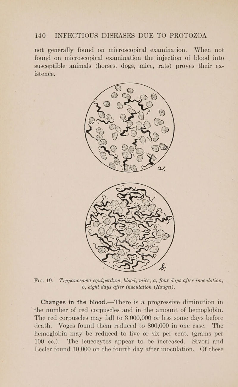 not generally found on microscopical examination. When not found on microscopical examination the injection of blood into | susceptible animals (horses, dogs, mice, rats) proves their ex- istence. Fia. 19. Trypanosoma equiperdum, blood, mice; a, four days after inoculation, b, etght days after inoculation (Rouget). Changes in the blood.—There is a progressive diminution in the number of red corpuscles and in the amount of hemoglobin. The red corpuscles may fall to 3,000,000 or less some days before death. Voges found them reduced to 800,000 in one case. The hemoglobin may be reduced to five or six per cent. (grams per 100 ec.). The leucocytes appear to be increased. Sivori and Lecler found 10,000 on the fourth day after inoculation. Of these