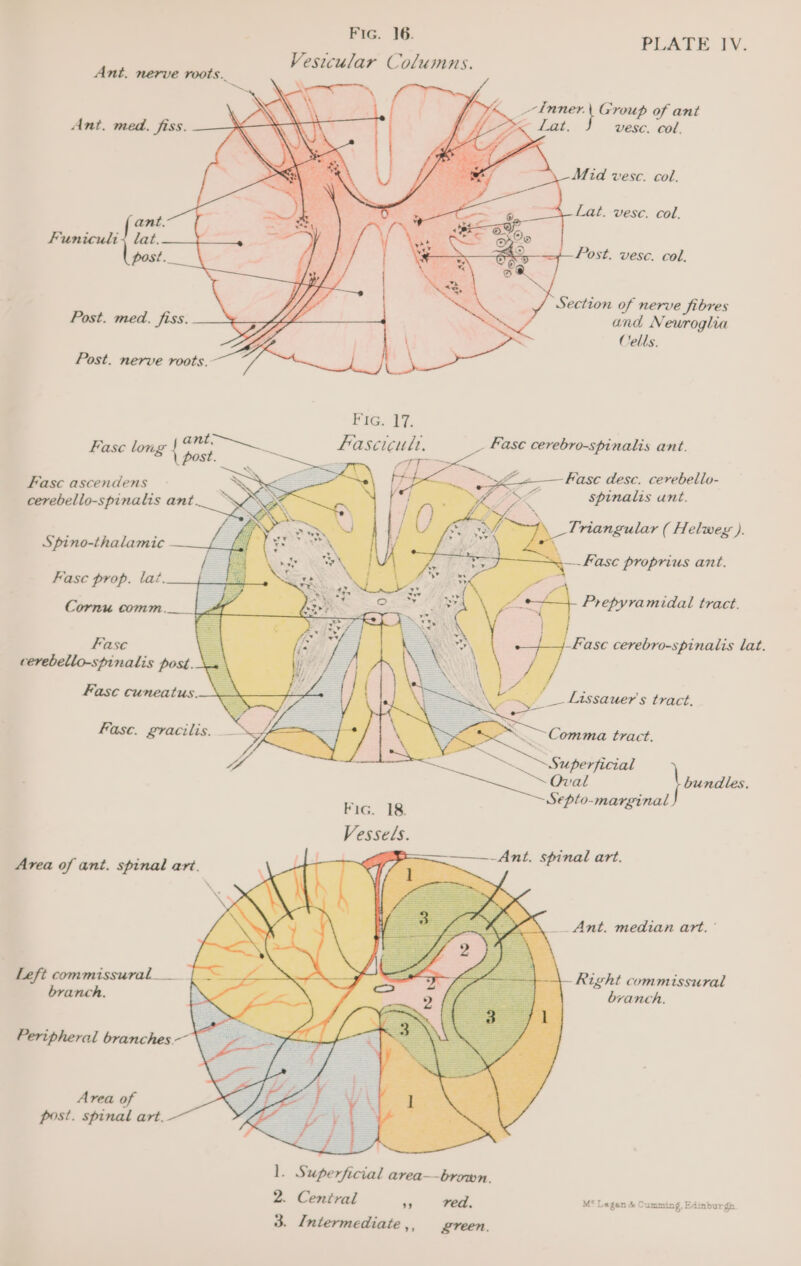 PLATE fv. _7-dnner. } Group of ant P Lez. vesc. col. Mid vesc. col. Section of nerve fibres and Neuroglia Cells. Puig, 77. Fase long i Fascicult. fs Fase cerebro-spinalis ant. Fasc ascendens Dp Fase desc. cerebello- cerebello-spinalis ant S LK spinalis unt. \ Triangular ( Helweg ). Spino-thalamic -yeapapa —.Fase proprius ant. Fasc prop. lat. Ba Cornu comm. Fase =e . eR / 41 Kase cerebro-spinalis lat. cerebello-spinalis post. \« Fasc cuneatus,. Fase. gracilis. - / f \ = &lt;—~Comma tract. } bundles. Septo-marginal ——-Ant. spinal art. Area of ant. spinal art. aenceiaail a __ Ant. median art. ° Left commissural___ Right commissural branch, branch. Peripheral branches. Area of post. spinal art. l. Superficial area—brown. 2. Central ”9 red. M* Lagen &amp; Cumming, Edinburgh