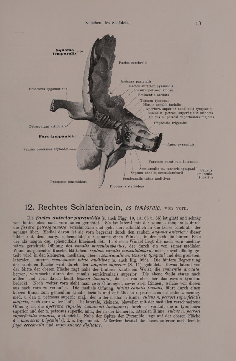 Squama _, temporalis Facies cerebralis Incisura parietalis hee Facies anterior pyramidis p Ware Fissura petrosquamosa BA Eminentia arcuata Processus zygomaticus maa _ Tegmen tympani “ /¥ Hiatus canalis facialis Impressio trigemini Tuberculum articulare” Pars tympanica ——— ry--—-- Apex pyramidis Vagina processus styloidei---- ------% j \ Foramen caroticum internum \ Y \ : : : = sie \ Semicanalis m. tensoris | Septum canalis musculotubarii 1 | l Semicanalis tubae auditivae rf Processus mastoideus w”---- Processus styloideus 12. Rechtes Schlafenbein, os femporale, von vorn. Die facies anterior pyramidis (s. auch Figg. 10, 13, 65 u. 66) ist glatt und schrig von hinten oben nach vorn unten gerichtet. Sie ist lateral mit der squama temporalis durch die fissura petrosquamosa verschmolzen und geht dort allmahlich in die facies cerebralis der squama tiber. Medial davon ist sie vorn begrenzt durch den rauhen angulus anterior ; dieser bildet mit dem margo sphenoidalis der squama einen Winkel, in den sich die hintere Ecke der ala magna oss. sphenoidalis hineinschiebt. In diesem Winkel liegt die nach vorn median- warts gerichtete Offnung des canalis musculotubarius, der durch ein von seiner medialen Wand ausgehendes Knochenblattchen, septum canalis musculotubarii, meist unvollstaindig ge- teilt wird in den kleineren, medialen, oberen semicanalis m. tensoris tympani und den gré8eren, lateralen, unteren semicanalis tubae auditivae (s. auch Fig. 985). Die hintere Begrenzung der vorderen Fliche wird durch den angulus superior (S. 11) gebildet. Etwas lateral von der Mitte der oberen Flaiche ragt nahe der hinteren Kante ein Wulst, die eminentia arcuata, hervor, verursacht durch den canalis semicircularis superior. Die ebene Stelle etwas nach auBen und vorn davon heifit tegmen tympani, da sie von oben her das cavum tympani bedeckt. Noch weiter vorn sieht man zwei Offnungen, sowie zwei Rinnen, welche von diesen aus nach yorn zu verlaufen. Die mediale Offnung, hiatus canalis facialis, fihrt durch einen kurzen Kanal zum geniculum canalis facialis und enthalt den r. petrosus superficialis a. mening. med. u. den n. petrosus superfic. maj., der in der medialen Rinne, sulcus n, petrost super ficialts majoris, nach vorn weiter lauft. Die laterale, kleinere, bisweilen mit der medialen verschmolzene Offnung ist die apertura supertor canaliculi tympanici; durch sie verliuft die a. tympanica superior und der n. petrosus superfic. min., der in der kleineren, lateralen Rinne, sulcus n. petrost superficialis minoris, weiterzieht. Nahe der Spitze der Pyramide liegt auf der oberen Fliche die tmpressio trigemint (f. d. n. trigeminus). AuBerdem besitzt die facies anterior noch leichte juga cerebralia und impressiones digitatae.