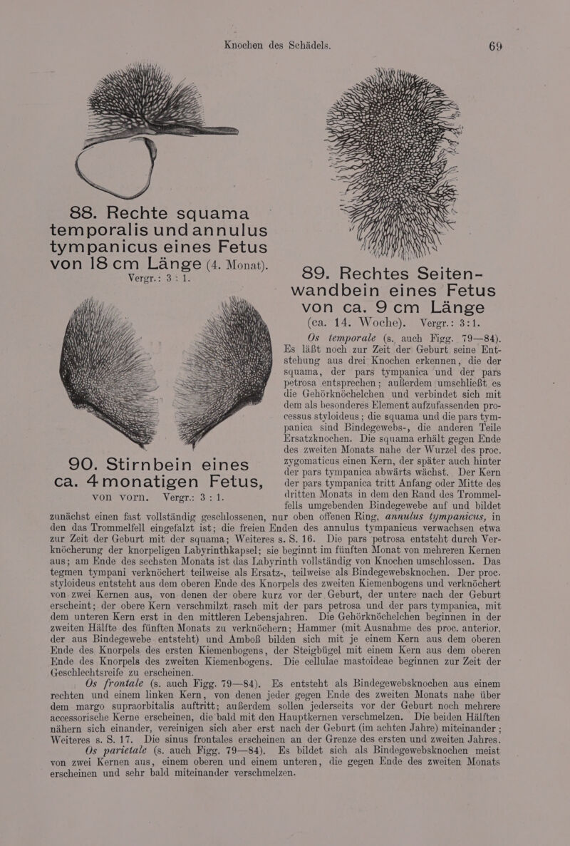 | —<ZAGEENN 88. Rechte squama — G GL NWA ‘ temporalis und annulus “ff TAINS s tympanicus eines Fetus eh | YANN von 18cm Lange (4. Monat). ie Aten vier a ee 4 Monat). 89. Rechtes Seiten- wandbein eines Fetus von ca. 9cm Lange (ca. 14. Woche). Vergr.: 3:1. Os temporale (s. auch Figg. 79—84). Es 1a8t noch zur Zeit der Geburt seine Ent- stehung aus drei Knochen erkennen, die der squama, der pars tympanica und der pars petrosa entsprechen; auferdem umschlieBt es die Gehérknéchelchen und verbindet sich mit dem als besonderes Element aufzufassenden pro- cessus styloideus ; die squama und die pars tym- panica sind Bindegewebs-, die anderen Teile Ersatzknochen. Die squama erhalt gegen Ende des zweiten Monats nahe der Wurzel des proc. 90 Sti r - bein eines zygomaticus einen Kern, der spiter auch hinter der pars tympanica abwarts wichst. Der Kern ca. 4mon atige n Fetu >, der pars tympanica tritt Anfang oder Mitte des Ny dritten Monats in dem den Rand des Trommel- Rg ee he a fells umgebenden Bindegewebe auf und bildet zunachst einen fast vollstindig geschlossenen, nur oben offenen Ring, annulus tympanicus, in den das Trommelfell eingefalzt ist; die freien Enden des annulus tympanicus verwachsen etwa zur Zeit der Geburt mit der squama; Weiteres s.8. 16. Die pars petrosa entsteht durch Ver- knécherung der knorpeligen Labyrinthkapsel; sie beginnt im fiinften Monat von mehreren Kernen aus; am Ende des sechsten Monats ist das Labyrinth vollstaéndig von Knochen umschlossen. Das tegmen tympani verknéchert teilweise als Ersatz-, teilweise als Bindegewebsknochen. Der proc. styloideus entsteht aus dem oberen Ende des Knorpels des zweiten Kiemenbogens und verknéchert von, zwei Kernen aus, von denen der obere kurz vor der. Geburt, der untere nach der Geburt erscheint; der obere Kern verschmilzt rasch mit der pars petrosa und der pars tympanica, mit dem unteren Kern erst in den mittleren Lebensjahren. Die Gehdrknéchelchen beginnen in der zweiten Hilfte des. fiinften Monats zu verknéchern; Hammer (mit Ausnahme des proc. anterior, der aus Bindegewebe entsteht) und Ambof bilden sich mit je einem Kern aus dem oberen Ende des Knorpels des ersten Kiemenbogens, der Steigbtigel mit einem Kern aus dem oberen Ende des Knorpels des zweiten Kiemenbogens. Die cellulae mastoideae beginnen zur Zeit der Geschlechtsreife zu erscheinen. Os frontale (s. auch Figg. 79—84). Es entsteht als Bindegewebsknochen aus einem rechten und einem linken Kern, von denen jeder gegen Ende des zweiten Monats nahe iiber dem margo supraorbitalis auftritt; auferdem sollen jederseits vor der Geburt noch mehrere accessorische Kerne erscheinen, die bald mit den Hauptkernen verschmelzen. Die beiden Hilften nahern sich einander, vereinigen sich aber erst nach der Geburt (im achten Jahre) miteinander ; Weiteres s. 8.17. Die sinus frontales erscheinen an der Grenze des ersten und zweiten Jahres. Os parietale (s. auch Figg. 79—84). Es bildet sich als Bindegewebsknochen meist von zwei Kernen aus, einem oberen und einem unteren, die gegen Ende des zweiten Monats erscheinen und sehr bald miteinander verschmelzen.