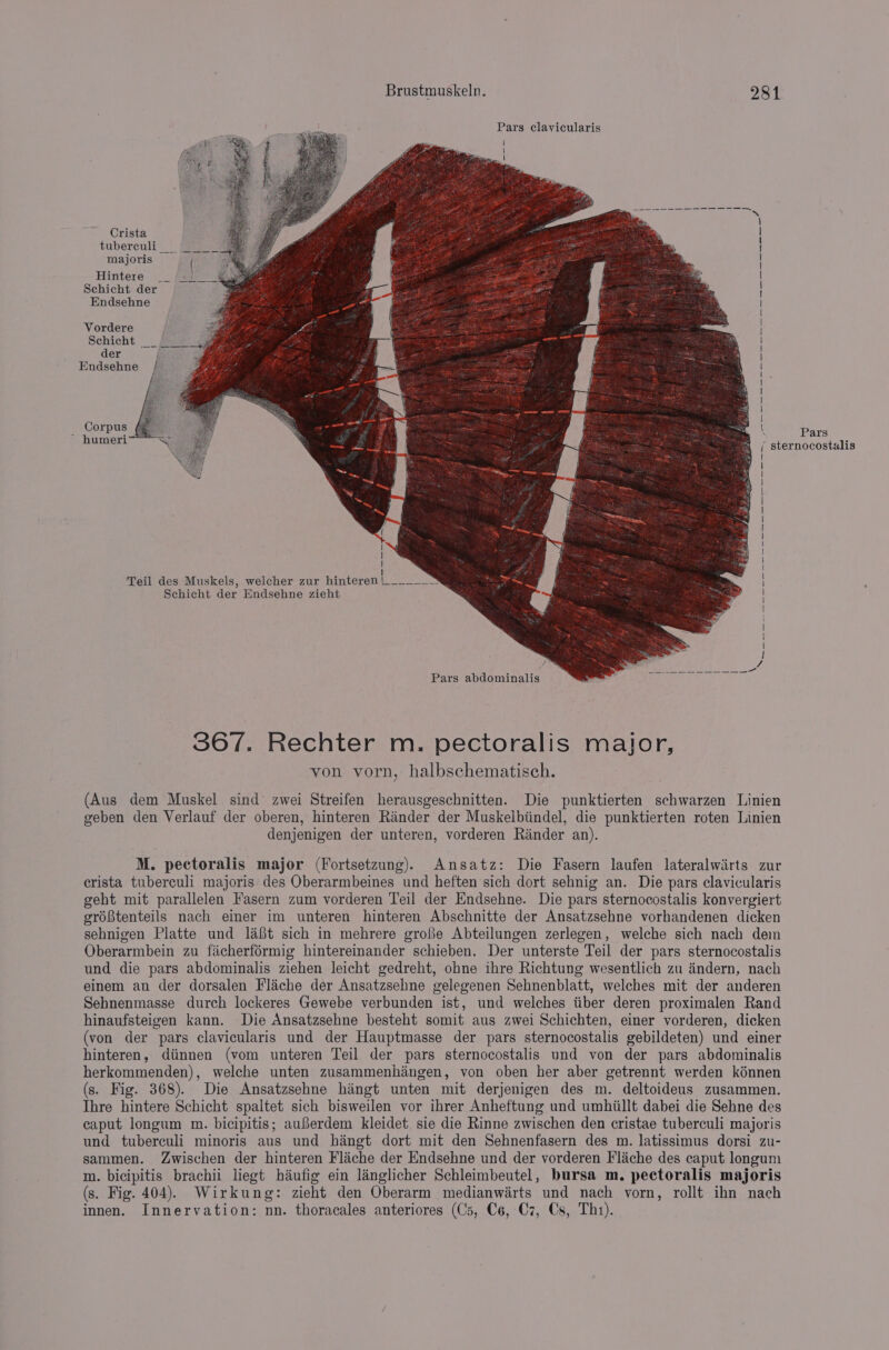 Pars clayicularis Crista tubercult_ = majoris Hintere Schicht der Endsehne Vordere Schicht der Endsehne Pars ‘ sternocostalis ! Teil des Muskels, welcher zur hinteren |______ Schicht der Endsehne zieht f= Pars abdominalis 367. Rechter m. pectoralis major, von vorn, halbschematisch. (Aus dem Muskel sind zwei Streifen herausgeschnitten. Die punktierten schwarzen Linien geben den Verlauf der oberen, hinteren Rander der Muskelbiindel, die punktierten roten Linien denjenigen der unteren, vorderen Rinder an). M. pectoralis major (Fortsetzung). Ansatz: Die Fasern laufen lateralwiirts zur crista tuberculi majoris des Oberarmbeines und heften sich dort sehnig an. Die pars clavicularis geht mit parallelen Fasern zum vorderen Teil der Endsehne. Die pars sternocostalis konvergiert gréBtenteils nach einer im unteren hinteren Abschnitte der Ansatzsehne vorhandenen dicken sehnigen Platte und l&amp;{t sich in mehrere grofe Abteilungen zerlegen, welche sich nach dem Oberarmbein zu facherformig hintereinander schieben. Der unterste Teil der pars sternocostalis und die pars abdominalis ziehen leicht gedreht, ohne ihre Richtung wesentlich zu dndern, nach einem an der dorsalen Flache der Ansatzsehne gelegenen Sehnenblatt, welches mit der anderen Sehnenmasse durch lockeres Gewebe verbunden ist, und welches tiber deren proximalen Rand hinaufsteigen kann. Die Ansatzsehne besteht somit aus zwei Schichten, einer vorderen, dicken (von der pars clavicularis und der Hauptmasse der pars sternocostalis gebildeten) und einer hinteren, diinnen (vom unteren Teil der pars sternocostalis und von der pars abdominalis herkommenden), welche unten zusammenhingen, von oben her aber getrennt werden kénnen (s. Fig. 368). Die Ansatzsehne hiingt unten mit derjenigen des m. deltoideus zusammen. Ihre hintere Schicht spaltet sich bisweilen vor ihrer Anheftung und umhiillt dabei die Sehne des caput longum m. bicipitis; auBberdem kleidet sie die Rinne zwischen den cristae tuberculi majoris und tuberculi minoris aus und hangt dort mit den Sehnenfasern des m. latissimus dorsi zu- sammen. Zwischen der hinteren Flache der Endsehne und der vorderen Flache des caput longum m. bicipitis brachii liegt haufig ein langlicher Schleimbeutel, bursa m, pectoralis majoris (s. Fig. 404). Wirkung: zieht den Oberarm medianwirts und nach vorn, rollt ihn nach innen. Innervation: nn. thoracales anteriores (Cs, C6, C7, Cs, Thi).