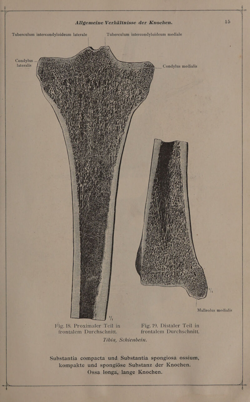 Tuberculum intercondyloideum laterale Tubereulum intercondyloideum mediale Condylus. lateralis Condylus medialis Malleolus medialis ;; 1 Fig. 18. Proximaler Teil in Fig. 19. Distaler Teil in frontalem Durchschnitt, frontalem Durchschnitt. Tibia, Schienbein. Substantia compacta und Substantia spongiosa ossium, kompakte und spongiöse Substanz der Knochen.