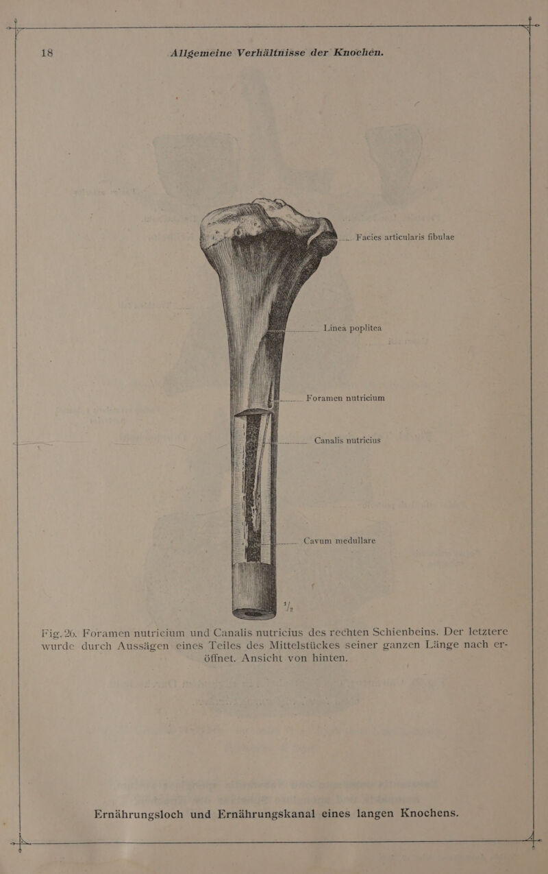 -_.. Facies articularis fibulae ___ Linea poplitea u Foramen nutricium Canalis nutricius Cavum medullare Fie.26. Foramen nutricium und Canalis nutriceius des rechten Schienbeins. Der letztere wurde durch Aussägen eines Teiles des Mittelstückes seiner ganzen Länge nach er- öffnet. Ansicht von hinten.