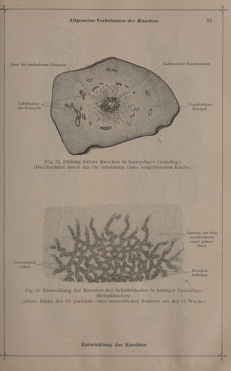 Zone des veränderten Knorpels ER Ben Enchondraler Knochenkern Gefäßkanäle — = ... Vorgebildeter des Knorpels Knorpel Fig. 33. Bildung kurzer Knochen in knorpeliger Grundlage. (Durchschnitt durch das Os cuboideum eines neugeborenen Kindes.) „. Gewebe der Pars membranacea cranii primor- dialis Östeoblasten- __! reihen 5: _ Knochen- bälkchen 20/ ‚1 Fig. 34. Entwicklung der Knochen des Schädeldaches in häutiger Grundlage (Belegknochen). (Obere Hälfte des Os parietale eines menschlichen Embryo aus der 11. Woche.)