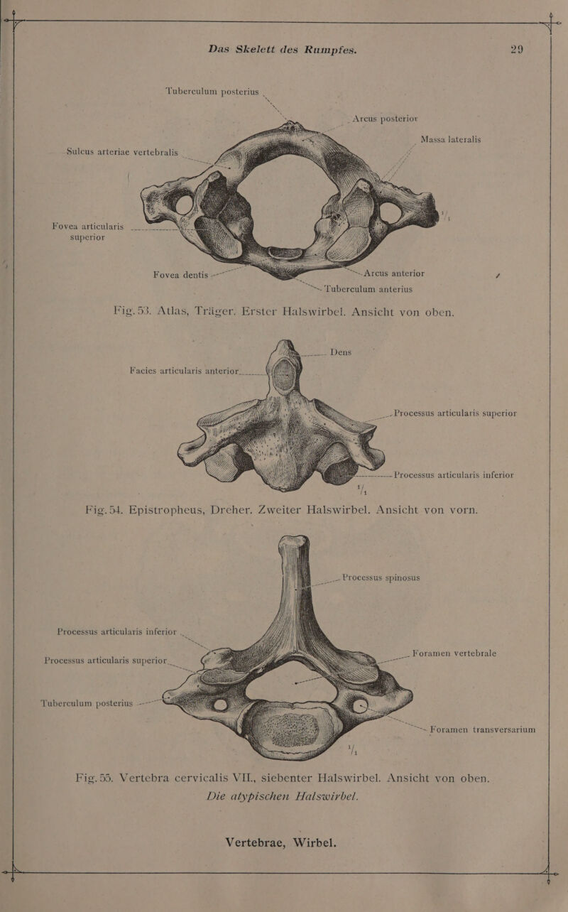 Tuberculum posterius | Sen _ Arcus posterior ‚ Massa lateralis Sulcus arteriae vertebralis _ Fovea articularis superior Fovea dentis &gt;. Arcus anterior ä &gt;. Tuberculum anterius Fig.53. Atlas, Träger. Erster Halswirbel. Ansicht von oben. Dens Facies articularis anterior ._„Processus articularis superior -——------ Processus articularis inferior 1 li Fig.54. Epistropheus, Dreher. Zweiter Halswirbel. Ansicht von vorn. __. Processus spinosus Processus articularis inferior . ‚... Foramen vertebrale Processus articularis superior___ Tuberculum posterius ---— &gt;. Foramen transversarium Fig.55. Vertebra cervicalis VIL, siebenter Halswirbel. Ansicht von oben. Die atypischen Halswirbel.