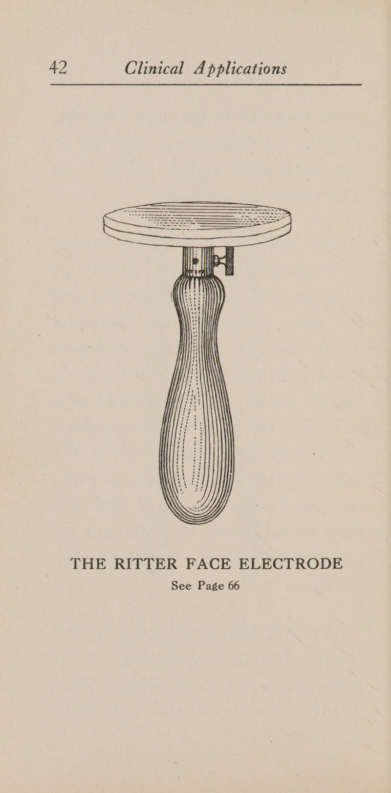 THE RITTER FACE ELECTRODE See Page 66