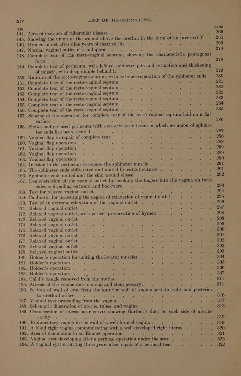 X1V FIG. LIST OF ILLUSTRATIONS. Area of excision of tubercular disease : Showing the union of the wound above the iaeih in fhe fore ne an caeey 4 Hymen intact after nine years of married life Normal vaginal outlet in a nullipara ; Complete tear of the recto-vaginal septum, showing ie chatactecene pentacada form Complete tear is Bene as sae genned polanctee ae hi retricnen oa fhicktenine of muscle, with deep dimple behind it ; Rupture of the recto-vaginal septum, with extreme cance af the ap kine ones : Complete tear of the recto-vaginal septum . Complete tear of the recto-vaginal septum . Complete tear of the recto-vaginal septum . Complete tear of the recto-vaginal septum . Complete tear of the recto-vaginal septum . Complete tear of the recto-vaginal septum . Scheme of the operation for spe A tear of the recto: ~vaginal septum laid ona flat surface . Shows badly closed perineum man excessive scar tissue in which no union ot anh ter ends has been secured . ; Vaginal flap in repair of complete tear Vaginal flap operation Vaginal flap operation Vaginal flap operation Vaginal flap operation : Incision in the perineum to expose ‘the aphieeee aeete : The sphincter ends obliterated and united by catgut sutures . Sphincter ends united and the skin wound closed Demonstration of the vaginal outlet by hooking the finger: tate the wagian on heen sides and pulling outward and backward Test for relaxed vaginal outlet ‘ Calibrator for measuring the degree of felavanad of seeced putlert Test of an extreme relaxation of the vaginal outlet Relaxed vaginal outlet Relaxed vaginal outlet, with perfect preceanen of ee Relaxed vaginal outlet Relaxed vaginal outlet Relaxed vaginal outlet Relaxed vaginal outlet Relaxed vaginal outlet Relaxed vaginal outlet Relaxed vaginal outlet Holden’s operation for Gone the devnaae enets Holden’s operation Holden’s operation Holden’s operation ; Child’s bangle removed from the need ‘ Atresia of the vagina due to a cup and stem ae : Section of wall of cyst from the anterior wall of vagina ase to ene ar fostories to urethral orifice Vaginal cyst protruding from ae aoe Schematic illustration of uterus, tubes, and vagina | Cross section of uterus near cervix showing Gartner’s ae on oye side oe aoe cavity é : Rudimentary vagina in ne a of a mere foumedt teas ; A blind right vagina communicating with a well- developed ee Sirus Area of denudation in an Emmet operation ‘ Vaginal cyst developing after a perineal operation Hees: ie scar . A vaginal cyst occurring three years after repair of a perineal tear PAGE 265 265 269 274 278 279 280 281 282 282 283. 284 285 286 287 288 288 289 289 290 291 291 292 293 294 295 297 298 298 299 300 301 302 303 303 304 305 306 307 311 311 316 317 318 319 319 320 321. 322 322.