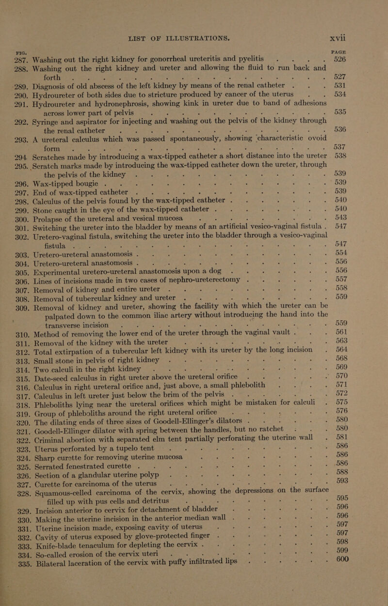 forth across lower part of pelvis the renal catheter form . Scratches made hy iene a peed batheter a ore aininne aie ‘the refer the pelvis of the kidney fistula Removal of kidney and ureter, showing the uitty with Which: the ae can be palpated down to the common iliac artery without introducing the hand into the transverse incision Method of removing the tics ane of the feeer aS the wianial vault . Removal of the kidney with the ureter : Total extirpation of a tubercular left kidney wit ie after i the long i incision Small stone in pelvis of right kidney Two calculi in the right kidney Date-seed calculus in right ureter Aeiae the eee prince Calculus in right ureteral orifice and, just above, a small phlebolith Calculus in left ureter just below the brim of the pelvis : Phleboliths lying near the ureteral orifices which might be Peed ne icali Group of phleboliths around the right ureteral orifice . The dilating ends of three sizes of Goodell-Ellinger’s dilators . Goodell-Ellinger dilator with spring between the handles, but no eeehet ; Criminal abortion with separated elm tent partially perforating the uterine wall Uterus perforated by a tupelo tent Sharp curette for removing uterine mucosa Serrated fenestrated curette Section of a glandular uterine polyp Curette for carcinoma of the uterus Squamous-celled carcinoma of the cervix, one. the Fostering sc on the Boriate filled up with pus cells and detritus — Incision anterior to cervix for detachment of piaider Making the uterine incision in the anterior median wall Uterine incision made, exposing cavity of uterus Cavity of uterus ees) by glove-protected finger Knife-blade tenaculum for depleting the cervix . So-called erosion of the cervix uteri. Bilateral laceration of the cervix with putty: iaflersted lips PAGE 526 527 ool 534 535 536 5037 038 539 539 939 540 540 543 547 547 554 596 906 557 508 059 9009 561 563 564 568 569 570 ov1 572 5795 576 580 080 581 586 586 586 588 593 595 596 596 597 597 598 599 600