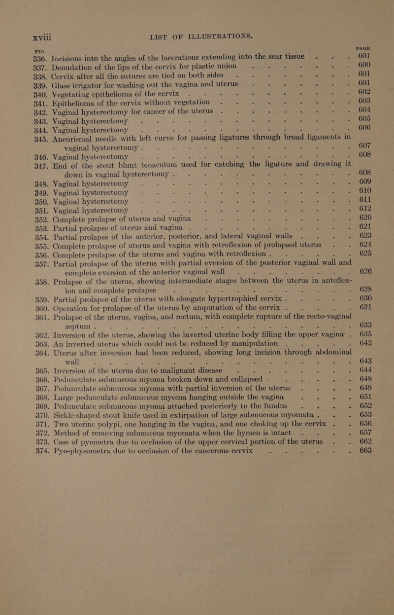 FIG. Incisions into the angles of the lacerations extending into the scar tissue. . Denudation of the lips of the cervix for plastic union Cervix after all the sutures are tied on both sides . . + + «| . Glass irrigator for washing out the vagina and uterus 2% Se Maen a ee salad aaa Vegetating epithelioma of the cervix Epithelioma of the cervix without vegetation Vaginal hysterectomy for cancer of the uterus Vaginal hysterectomy Vaginal hysterectomy . Aneurismal needle with left curve ae pace iigneares hroueh broad leaner in vaginal hysterectomy . Vaginal hysterectomy End of the stout blunt tenaculum used for catching the ligature and drawing it down in vaginal hysterectomy . Vaginal hysterectomy Vaginal hysterectomy Vaginal hysterectomy Vaginal hysterectomy Complete prolapse of uterus aa vagina Partial prolapse of uterus and vagina Partial prolapse of the anterior, posterior, and Haber vaginas all Complete prolapse of uterus and vagina with retroflexion of prolapsed uterus Complete prolapse of the uterus and vagina with retroflexion . Partial prolapse of the uterus with partial eversion of the posterior vaginal ah ai complete eversion of the anterior vaginal wall Prolapse of the uterus, showing intermediate stages beeen the Serie in thes ion and complete prolapse ; s Partial prolapse of the uterus with claheare foveroniet cervix . Operation for prolapse of the uterus by amputation of the cervix . Prolapse of the uterus, vagina, and rectum, with complete rupture of the Pee ane septum . : Inversion of the RPSAce Wee rhe iirested Teenie Bore filling the fe vane : An inverted uterus which could not be reduced by manipulation Uterus after inversion had been reduced, showing long incision through ncaa wall Inversion of the tere oe to tvalonant Aiea . : Pedunculate submucous myoma broken down and iat PRON eat tag np 5 Pedunculate submucous myoma with partial inversion of the uterus . . . Large pedunculate submucous myoma hanging outside the vagina : : é Pedunculate submucous myoma attached posteriorly tothe fundus . . . . Sickle-shaped stout knife used in extirpation of large submucous myomata. . . Two uterine polypi, one hanging in the vagina, and one choking up the cervix . . Method of removing submucous myomata when the hymen is intact Case of pyometra due to occlusion of the upper cervical portion of the uterus Pyo-physometra due to occlusion of the cancerous cervix 621 623 624 625 626 628 630 631 633 635 642 643 644 648 649 651 652 653 656 657 662 663