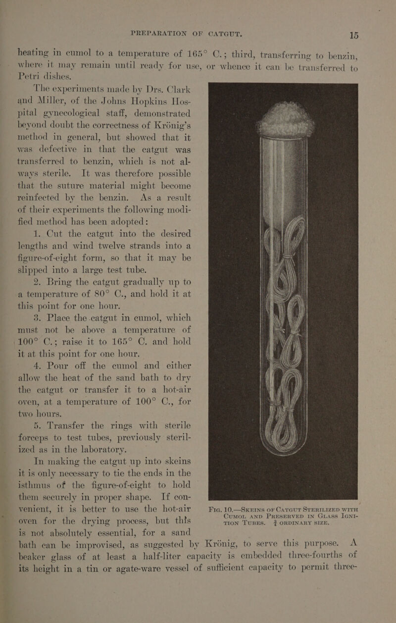 Petri dishes. The experiments made by Drs. Clark and Miller, of the Johns Hopkins Hos- pital gynecological staff, demonstrated beyond doubt the correctness of Krénig’s method in general, but showed that it was defective in that the catgut was transferred to benzin, which is not al- ways sterile. It was therefore possible reinfected by the benzin. As a result of their experiments the following modi- fied method has been adopted: 1. Cut the catgut into the desired lengths and wind twelve strands into a figure-of-eight form, so that it may be slipped into a large test tube. 2. Bring the catgut gradually up to a temperature of 80° C., and hold it at this point for one hour. 3. Place the catgut in eumol, which must not be above a temperature of Heel. raise it to 165° ©, and: hold it at this point for one hour. 4. Pour off the eumol and either allow the heat of the sand bath to dry oven, at a temperature of 100° C., for two hours. 5. Transfer the rings with sterile forceps to test tubes, previously steril- ized as in the laboratory. | In making the catgut up into skeins it is only necessary to tie the ends in the isthmus of the figure-of-eight to hold them securely in proper shape. If con- venient, it is better to use the hot-air oven for the drying process, but this is not absolutely essential, for a sand Fig. 10.—SKEINS oF CATGUT STERILIZED WITH CuMoL AND PRESERVED IN GLASss IGNI- TION TUBES. ‘#} ORDINARY SIZE.
