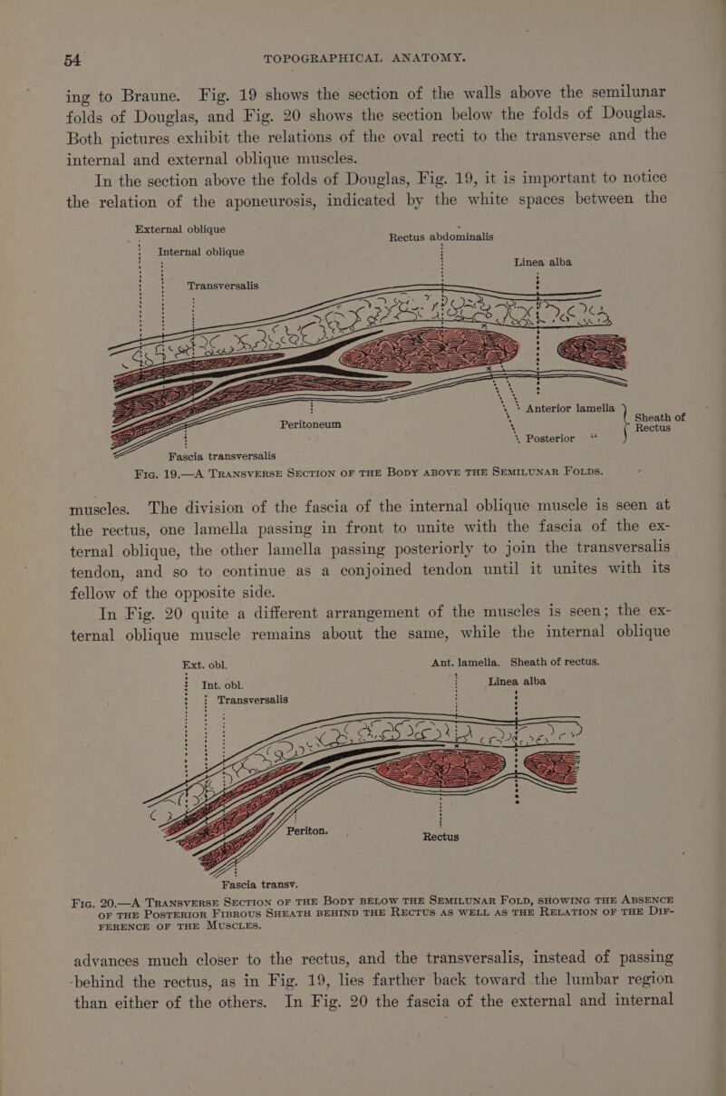 ing to Braune. Fig. 19 shows the section of the walls above the semilunar folds of Douglas, and Fig. 20 shows the section below the folds of Douglas. Both pictures exhibit the relations of the oval recti to the transverse and the internal and external oblique muscles. , In the section above the folds of Douglas, Fig. 19, it is important to notice the relation of the aponeurosis, indicated by the white spaces between the External oblique 5 : Rectus abdominalis Internal oblique : Linea alba Transversalis ; : ee ee ee ee ere eo coe- SY, Z —— epg owe é Pe pig vo - ¢ Pa 4 . a) ® Sheath of mS &lt; Anterior lamella Rectus : * Posterior ‘‘ Fascia transversalis Fig. 19.—A TRANSVERSE SECTION OF THE BoDY ABOVE THE SEMILUNAR FOLDS. muscles. The division of the fascia of the internal oblique muscle is seen at the rectus, one lamella passing in front to unite with the fascia of the ex- ternal oblique, the other lamella passing posteriorly to join the transversalis tendon, and so to continue as a conjoined tendon until it unites with its fellow of the opposite side. In Fig. 20 quite a different arrangement of the muscles is seen; the ex- ternal oblique muscle remains about the same, while the internal oblique Ext. obl. Ant. lamella. Sheath of rectus. Int. obl. : ‘Linea alba . Mi r) : : Transversalis Fic. 20.—A TRANSVERSE SECTION OF THE BoDY BELOW THE SEMILUNAR FOLD, SHOWING THE ABSENCE OF THE PosTERIOR Frsrous SHEATH BEHIND THE RECTUS AS WELL AS THE RELATION OF THE Dir- FERENCE OF THE MUSCLES. advances much closer to the rectus, and the transversalis, instead of passing -behind the rectus, as in Fig. 19, lies farther back toward the lumbar region than either of the others. In Fig. 20 the fascia of the external and internal