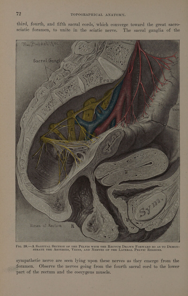 third, fourth, and fifth sacral cords, which converge toward the great sacro- The sacral ganglia of the sciatic foramen, to unite in the sciatic nerve. io Fic. 38.—A SAGITTAL SECTION OF THE PELVIS WITH THE RECTUM DRAWN FORWARD SO AS TO DEMON- STRATE THE ARTERIES, VEINS, AND NERVES OF THE LATERAL PELVIC REGIONS. sympathetic nerve are seen lying upon these nerves as they emerge from the Observe the nerves going from the fourth sacral cord to the lower _ foramen. ‘part of the rectum and the coccygeus muscle.