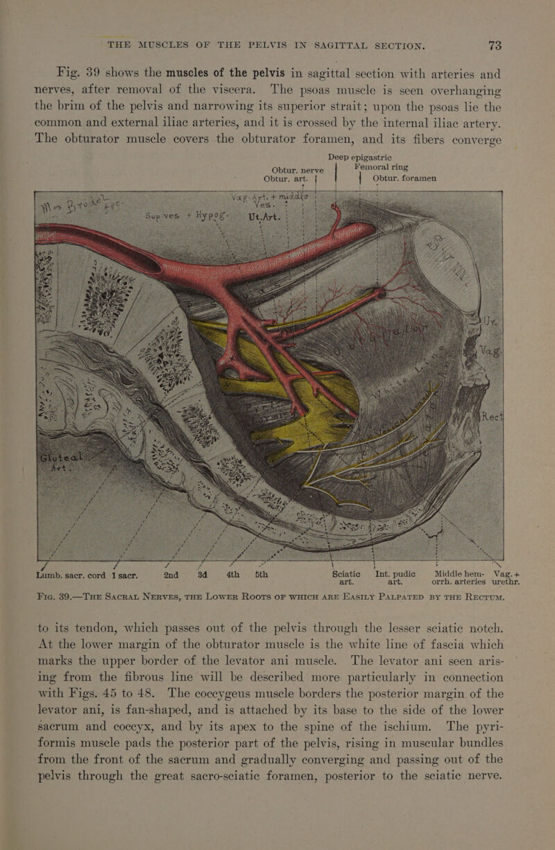 ee nme THE MUSCLES OF THE PELVIS IN SAGITTAL SECTION. 73 Fig. 39 shows the muscles of the pelvis in sagittal section with arteries and nerves, after removal of the viscera. The psoas muscle is seen overhanging the brim of the pelvis and narrowing its superior strait; upon the psoas lie the common and external iliac arteries, and it is crossed by the internal iliac artery. The obturator muscle covers the obturator foramen, and its fibers converge Deep epigastric Femoral ring Obtur. foramen Obtur. nerve Obtur. art. | F j t é  amen 7 é a # : &lt; : ‘ ‘ * ‘ , ‘ “ Lumb. sacr. cord 1 sacr. 2nd 3d 4th 5th Sciatic Int. pudic Middle hem- Vag.+ eh art. art. orrh. arteries urethr, Fig. 39.—TuHeE Sacrat NERVES, THE LOWER ROOTS OF WHICH ARE EASILY PALPATED BY THE RECTUM. to its tendon, which passes out of the pelvis through the lesser sciatic notch. At the lower margin of the obturator muscle is the white line of fascia which marks the upper border of the levator ani muscle. The levator ani seen aris- ing from the fibrous line will be described more particularly in connection with Figs. 45 to 48. The coccygeus muscle borders the posterior margin of the levator ani, is fan-shaped, and is attached by its base to the side of the lower sacrum and coccyx, and by its apex to the spine of the ischium. The pyri- formis muscle pads the posterior part of the pelvis, rising in muscular bundles from the front of the sacrum and gradually converging and passing out of the pelvis through the great sacro-sciatic foramen, posterior to the sciatic nerve.