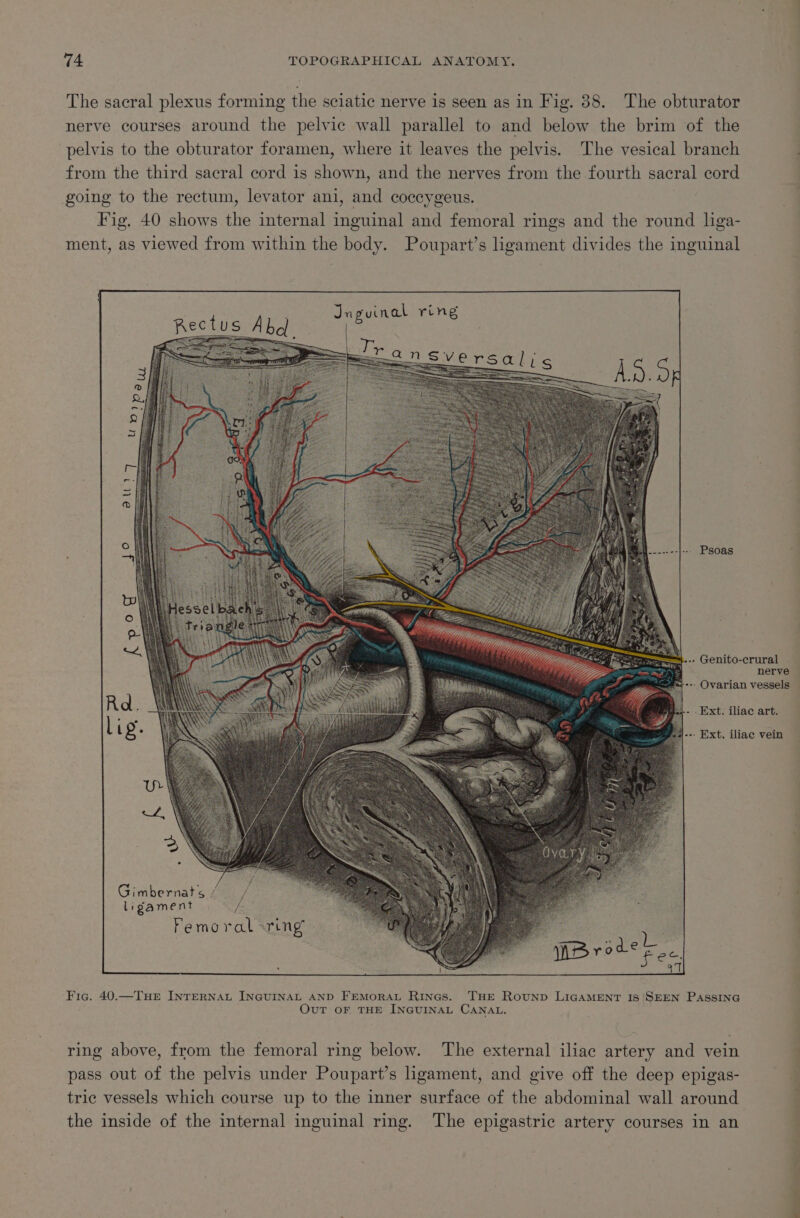 The sacral plexus forming the sciatic nerve is seen as in Fig. 38. The obturator nerve courses around the pelvic wall parallel to and below the brim of the pelvis to the obturator foramen, where it leaves the pelvis. The vesical branch from the third sacral cord is shown, and the nerves from the fourth sacral cord going to the rectum, levator ani, and coccygeus. 7 Fig. 40 shows the internal inguinal and femoral rings and the round liga- ment, as viewed from within the body. Poupart’s ligament divides the inguinal See mee rsalis i fh a ea 27 a Fic. 40.—TuHE INTERNAL INGUINAL AND FEMORAL Rines. THE Rounp LIGAMENT IS ‘SEEN PASSING OvuT OF THE INGUINAL CANAL. ring above, from the femoral ring below. The external iliac artery and vein pass out of the pelvis under Poupart’s ligament, and give off the deep epigas- the inside of the internal inguinal ring. The epigastric artery courses in an nerve ag ee