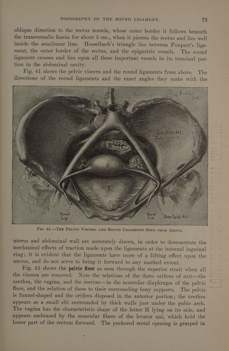 TOPOGRAPHY OF THE ROUND LIGAMENT. Ld oblique direction to the rectus muscle, whose outer border it follows beneath the transversalis fascia for about 5 cm., when it pierces the rectus and lies well inside the semilunar line. Heaselbacl: s triangle lies between Poupart’s liga- ment, the outer border of the rectus, and the epigastric vessels. The round ligament crosses and lies upon all Hee important vessels in its forminel por- _ tion in the abdominal cavity. Fig. 41 shows the pelvic viscera and the round ligaments from above. The directions of the round ligaments and the exact angles they make with the uterus and abdominal wall are accurately drawn, in order to demonstrate the mechanical effects of traction made upon the eames at the internal inguinal ring; it is evident that the ligaments have more of a lifting effect upon the uterus, and do not serve to bring it forward to any marked extent. Fig. 42 shows the pelvic floor as seen through the superior strait when all the viscera are removed. Note the relations of the three orifices of exit—the urethra, the vagina, and the rectum—in the muscular diaphragm of the pelvic floor, and the relation of these to their surrounding bony supports. The pelvis is funnel-shaped and the orifices disposed in the anterior portion; the urethra appears as a small slit surrounded by thick walls just under the pubic arch. The vagina has the characteristic shape of the letter H lying on its side, and appears embraced by the muscular fibers of the levator ani, which hold the lower part of the rectum forward. The puckered rectal opening is grasped in