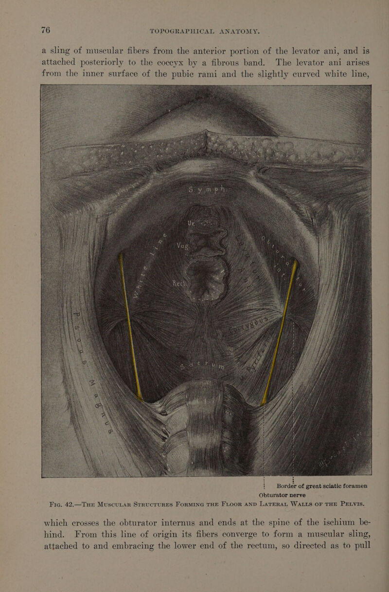 a sling of muscular fibers from the anterior portion of the levator ani, and is attached posteriorly to the coceyx by a fibrous band. The levator ani arises from the inner surface of the pubic rami and the slightly curved white line, Border of great sciatic foramen Obturator nerve Fig. 42.—TuHEr MuscuLar STRUCTURES FORMING THE FLOOR AND LATERAL WALLS OF THE PELVIS. which crosses the obturator internus and ends at the spine of the ischium be- hind. From this line of origin its fibers converge to form a muscular sling, attached to and embracing the lower end of the rectum, so directed as to pull