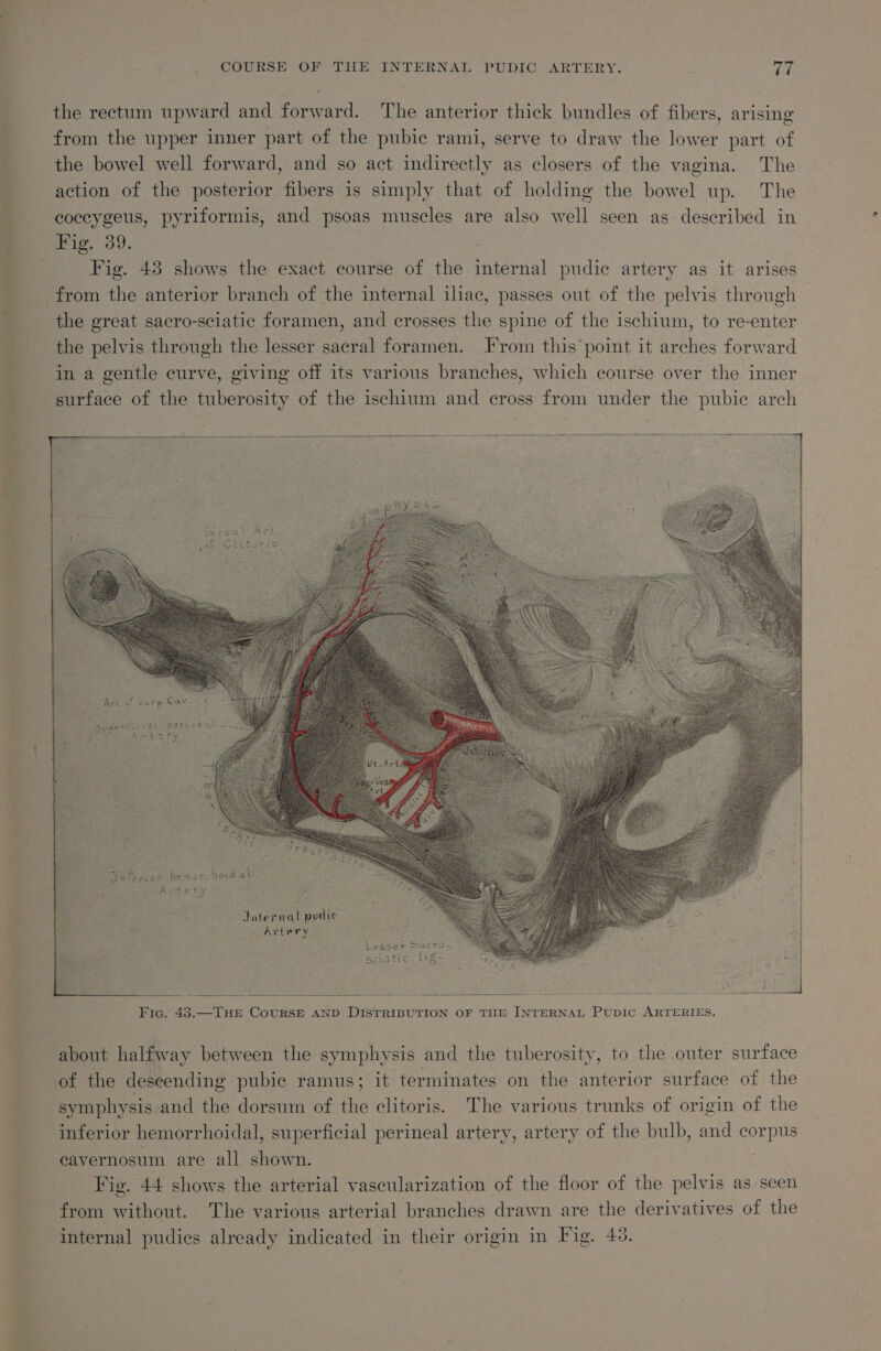 COURSE OF THE INTERNAL PUDIC ARTERY. Th the rectum upward and forward. The anterior thick bundles of fibers, arising from the upper inner part of the pubic rami, serve to draw the lower part of the bowel well forward, and so act indirectly as closers of the vagina. The action of the posterior fibers is simply that of holding the bowel up. The coccygeus, pyriformis, and psoas muscles are also well seen as described in | Fig. 39. Fig. 43 shows the exact course of the internal pudic artery as it arises from the anterior branch of the internal iliac, passes out of the pelvis through : the great sacro-sciatic foramen, and crosses the spine of the ischium, to re-enter i the pelvis through the lesser sacral foramen. From this point it arches forward im a gentle curve, giving off its various branches, which course over the inner surface of the tuberosity of the ischium and cross from under the pubic arch = cenpesenequaranvirnnsnnsihnanmnnnn ss aiesesnennnehsnts honda saan nanan nanaratonrnn manauanannnndstenntnnasanntennnanenantenn selvwesennsecee acs ehh unserer mie ech cesses ellanmenbon baie hinder totineraacae acne ithe as domeeicharaevte rote rire = Hers al Ay? en : (abe eT SES, Nierag = ale =e : ; Stay ee? dnisriot Ke mors Reid at Peer ony Internal pudic SASLOTY. Lesser Ducro- aepdtie: Less Fic. 43.—THE Course AND DISTRIBUTION OF TIIE INTERNAL Pupic ARTERIES. about halfway between the symphysis and the tuberosity, to the outer surface of the descending pubic ramus; it terminates on the anterior surface of the symphysis and the dorsum of the clitoris. The various trunks of origin of the inferior hemorrhoidal, superficial perineal artery, artery of the bulb, and corpus cavernosum are all shown. ; Fig. 44 shows the arterial vascularization of the floor of the pelvis as seen from without. The various arterial branches drawn are the derivatives of the internal pudics already indicated in their origin in Fig. 43.