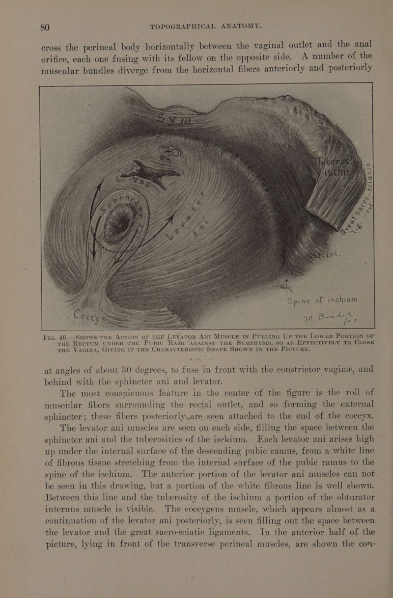 cross the perineal body horizontally between the vaginal outlet and the anal orifice, each one fusing with its fellow on the opposite side. A number of the muscular bundles diverge from the horizontal fibers anteriorly and posteriorly ‘Spine of ischium - \ yy. ae oe eG ¥ig. 46.—SuHows THE AcTION oF THE LEYATOR ANI MUSCLE IN PULLING Up THE LOWER PORTION OF THE RECTUM UNDER THE PuBIC “RAMI” AGAINST THE SYMPHYSIS, SO AS EFFECTIVELY TO CLOSE THE VAGINA, GIVING If THE CHARACTERISTIC SHAPE SHOWN IN THE PICTURE. at angles of about 30 degrees, to fuse in front with the constrictor vagine, and behind with the sphincter ani and levator. The most conspicuous feature in the center of the figure is the roll of muscular fibers surrounding the rectal outlet, and so forming the external sphincter; these fibers posteriorly.are seen attached to the end of the coccyx. The levator ani muscles are seen on.each side, filling the space between the sphincter ani and the tuberosities of the ischium. ach levator ani arises high up under the internal surface of the descending pubic ramus, from a white line of fibrous tissue stretching from the internal surface of the pubie ramus to the spine of the ischium. The anterior portion of the levator ani muscles can not. be seen in this drawing, but a portion of the white fibrous line is well shown. Between this line and the tuberosity of the ischium a portion of the obturator internus muscle is visible. The coceygeus muscle, which appears almost as a continuation of the levator ani posteriorly, is seen filling out the space between the levator and the great sacro-sciatic ligaments. In the anterior half of the picture, lying in front of the transverse perineal muscles, are shown the con-