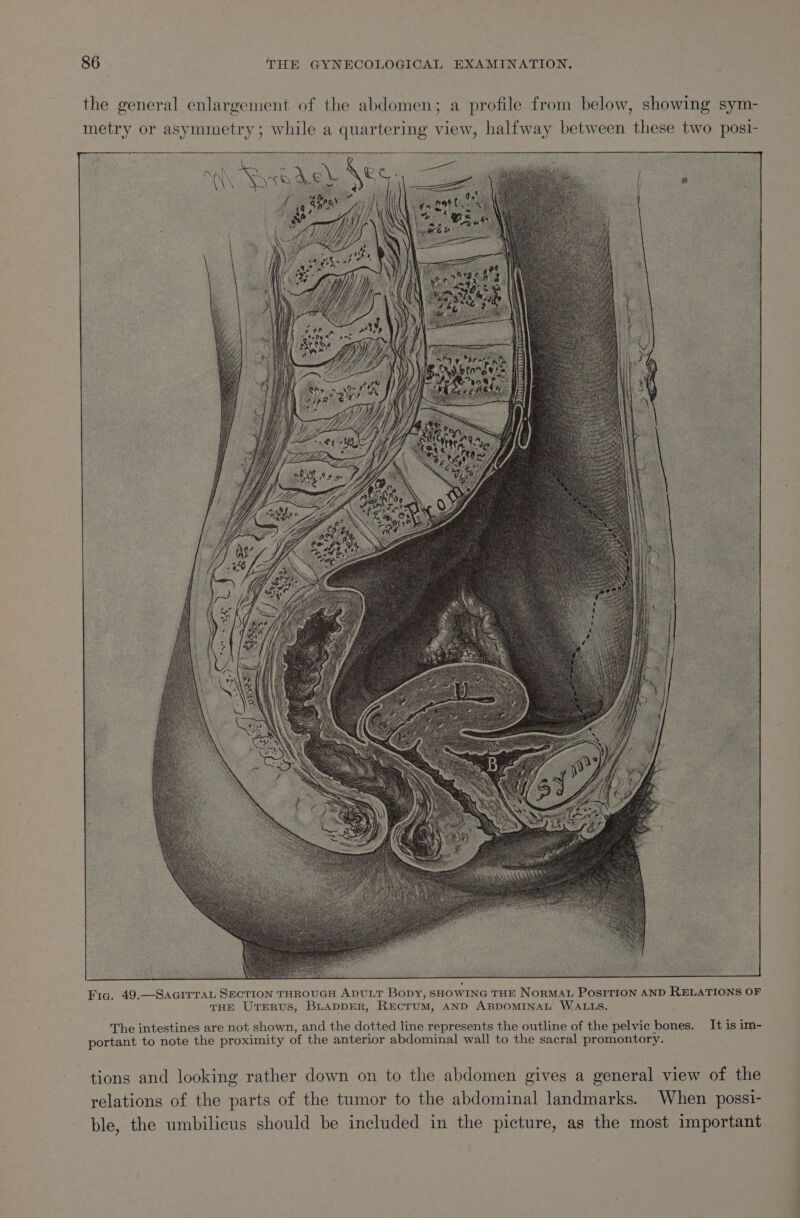 Fig. 49.—SacirraL SECTION THROUGH ADULT Bopy, SHOWING THE NORMAL POSITION AND RELATIONS OF THE Urrerus, BLADDER, REcTruM, AND ABDOMINAL WALLS. The intestines are not shown, and the dotted line represents the outline of the pelvic bones. It is im- portant to note the proximity of the anterior abdominal wall to the sacral promontory. tions and looking rather down on to the abdomen gives a general view of the relations of the parts of the tumor to the abdominal landmarks. When possi- ble, the umbilicus should be included in the picture, as the most important