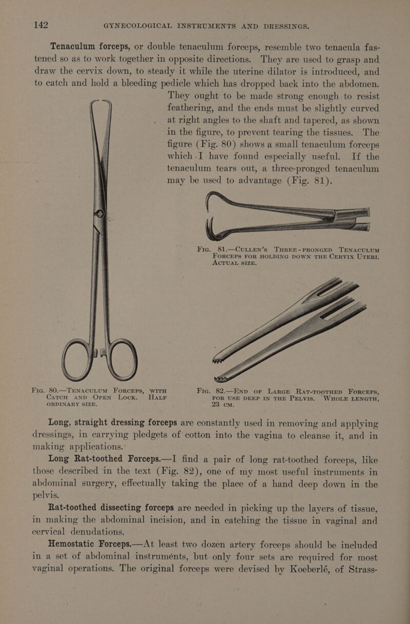 Tenaculum forceps, or double tenaculum forceps, resemble two tenacula fas- tened so as to work together in opposite directions. They are used to grasp and draw the cervix down, to steady it while the uterine dilator is introduced, and to catch and hold a bleeding pedicle which has dropped back into the abdomen. ib They ought to be made strong enough to resist Cs feathering, and the ends must be slightly curved at right angles to the shaft and tapered, as shown in the figure, to prevent tearing the tissues. The figure (Fig. 80) shows a small tenaculum forceps which .I have found especially useful. If the tenaculum tears out, a three-pronged tenaculum may be used to advantage (Fig. 81). sii nm ame Fic. 81.—CuLLEN’s THREE-PRONGED TENACULUM FORCEPS FOR HOLDING DOWN THE CERVIX UTERI. ACTUAL SIZE. nay Fig. 80.—TENACULUM FORCEPS, WITH Fie. 82.—Enp oF LarGn RaAtT-TOOTHED Roktu CatcH AND Opren Lock. HauF FOR USE DEEP IN THE PELVIS. WHOLE LENGTH, ORDINARY SIZE. 23 OM. Long, straight dressing forceps are constantly used in removing and applying dressings, in carrying pledgets of cotton into the vagina to cleanse it, and in making applications.: Long Rat-toothed Forceps.—I rl a pair of long rat-toothed forceps, like those described in the text (Fig. 82), one of my most useful instruments in abdominal surgery, effectually taking the place of a hand deep down in the pelvis. Rat-toothed dissecting forceps are needed in picking up the layers of tissue, in making the abdominal incision, and in catching the tissue in vaginal and cervical denudations. Hemostatic Forceps.—At least two dozen artery forceps should be included in a set of abdominal instruménts, but only four sets are required for most vaginal operations. The original forceps were devised by Koeberlé, of Strass-