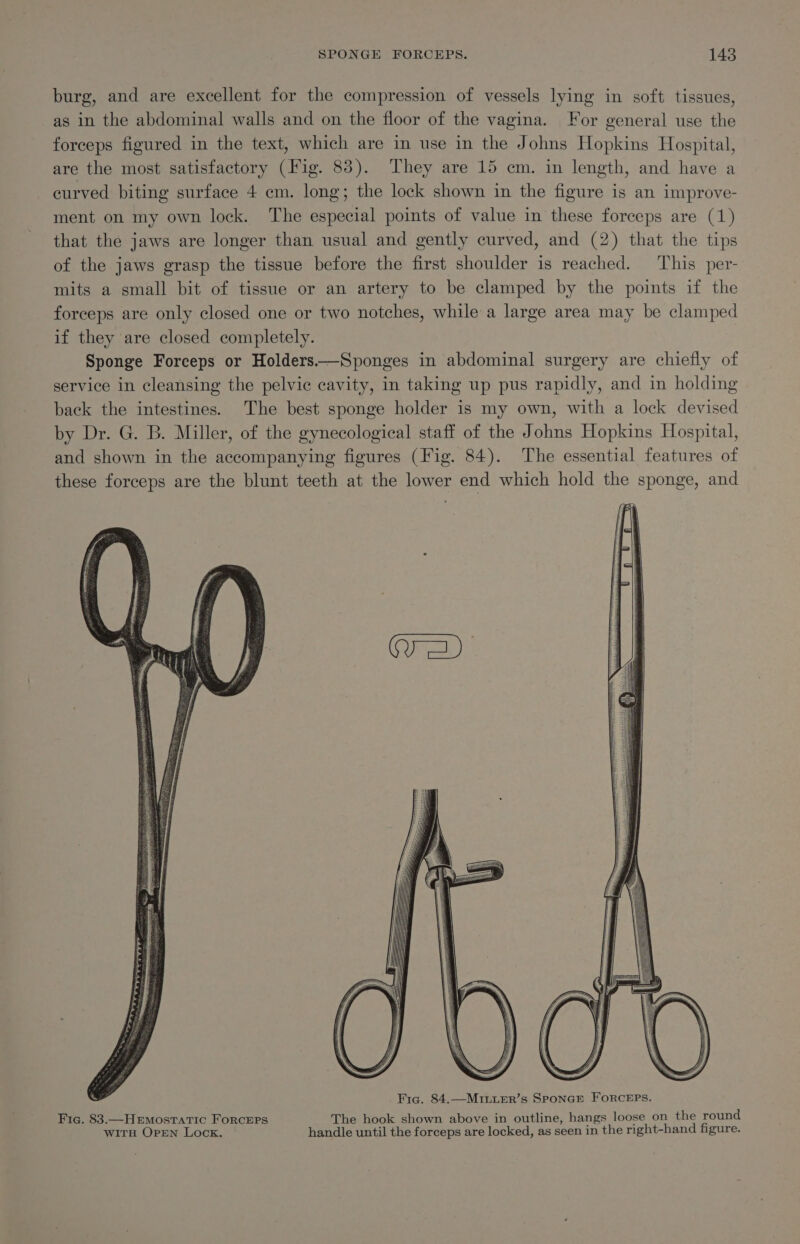 burg, and are excellent for the compression of vessels lying in soft tissues, as in the abdominal walls and on the floor of the vagina. For general use the forceps figured in the text, which are in use in the Johns Hopkins Hospital, are the most satisfactory (Fig. 83). They are 15 cm. in length, and have a curved biting surface 4 em. long; the lock shown in the figure is an improve- ment on my own lock. The especial points of value in these forceps are (1) that the jaws are longer than usual and gently curved, and (2) that the tips of the jaws grasp the tissue before the first shoulder is reached. This per- mits a small bit of tissue or an artery to be clamped by the points if the forceps are only closed one or two notches, while a large area may be clamped if they are closed completely. Sponge Forceps or Holders.—Sponges in abdominal surgery are chiefly of service in cleansing the pelvic cavity, in taking up pus rapidly, and in holding back the intestines. The best sponge holder is my own, with a lock devised by Dr. G. B. Miller, of the gynecological staff of the Johns Hopkins Hospital, and shown in the accompanying figures (Fig. 84). The essential features of these forceps are the blunt teeth at the lower end which hold the sponge, and Fig. 83.—HeEmostatic ForRcEPS The hook shown above in outline, hangs loose on the round WwiTH OPEN Lock. handle until the forceps are locked, as seen in the right-hand figure.