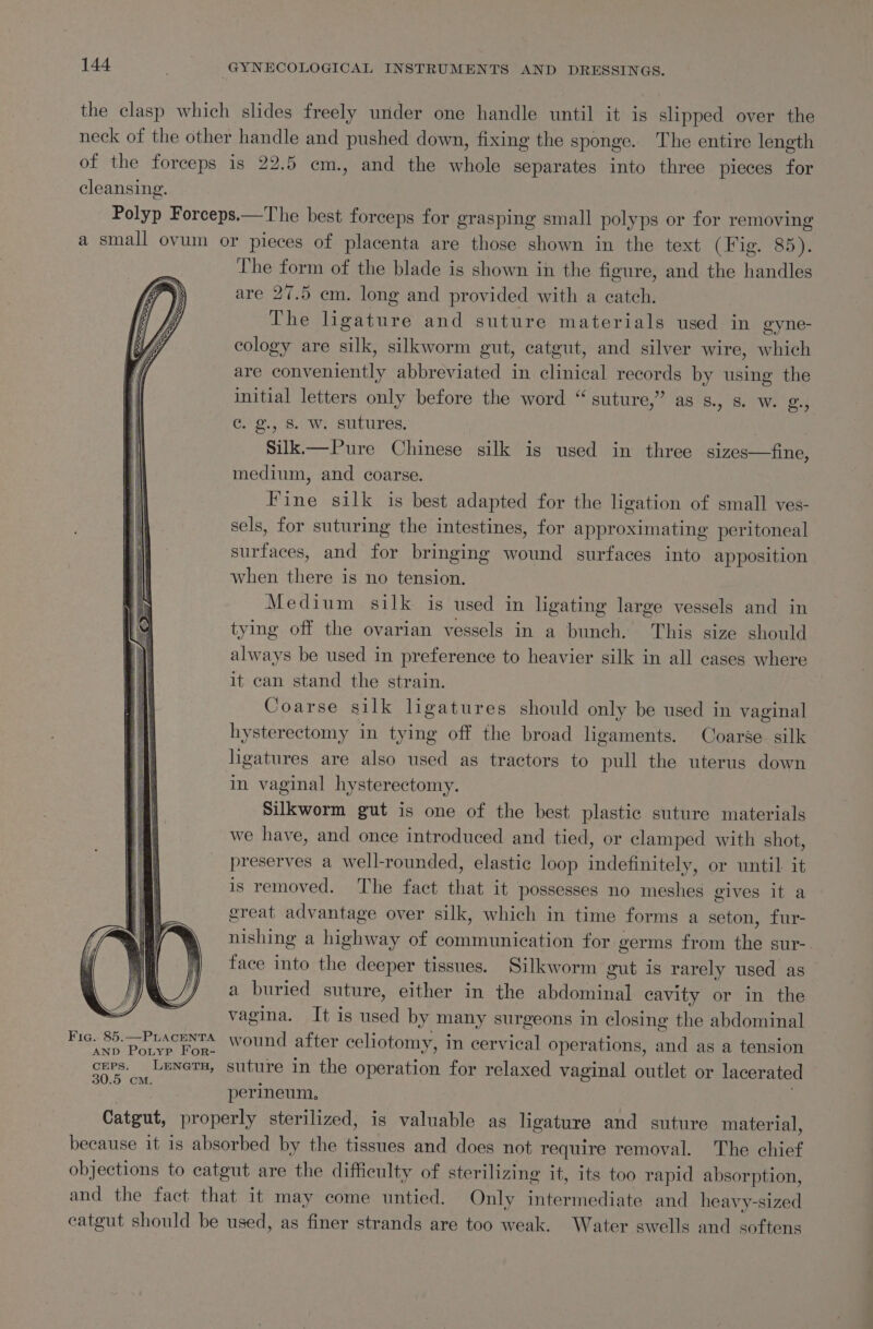 the clasp which slides freely under one handle until it is slipped over the neck of the other handle and pushed down, fixing the sponge. The entire length of the forceps is 22.5 em., and the whole separates into three pieces for cleansing. Polyp Forceps.—The best forceps for grasping small polyps or for removing a small ovum or pieces of placenta are those shown in the text (Fig. 85). The form of the blade is shown in the figure, and the handles are 27.5 cm. long and provided with a catch. The ligature and suture materials used in gyne- cology are silk, silkworm gut, catgut, and silver wire, which are conveniently abbreviated in clinical records by using the initial letters only before the word “ suture,” as s., 8. w. g., Cc. g., 8. W. sutures, Silki—Pure Chinese silk is used in three sizes—fine, medium, and coarse. Fine silk is best adapted for the ligation of small ves- sels, for suturing the intestines, for approximating peritoneal surfaces, and for bringing wound surfaces into apposition when there is no tension. Medium silk is used in ligating large vessels and in tying off the ovarian vessels in a bunch. This size should always be used in preference to heavier silk in all cases where it can stand the strain. Coarse silk ligatures should only be used in vaginal hysterectomy in tying off the broad ligaments. Coarse. silk ligatures are also used as tractors to pull the uterus down in vaginal hysterectomy. Silkworm gut is one of the best plastic suture materials we have, and once introduced and tied, or clamped with shot, preserves a well-rounded, elastic loop indefinitely, or until it is removed. The fact that it possesses no meshes gives it a great advantage over silk, which in time forms a seton, fur- nishing a highway of communication for germs from the sur- face into the deeper tissues. Silkworm gut is rarely used as a buried suture, either in the abdominal cavity or in the 2 vagina. It is used by many surgeons in closing the abdominal Fic. 85. Pracenta wound after celiotomy, in cervical operations, and as a tension AND Poryp For- buy. ’ | ( ’ pire, sy Nata suture in the operation for relaxed vaginal outlet or lacerate perineum. Catgut, properly sterilized, is valuable as ligature and suture material, because it 1s absorbed by the tissues and does not require removal. The chief objections to catgut are the difficulty of sterilizing it, its too rapid absorption, and the fact that it may come untied. Only intermediate and heavy-sized catgut should be used, as finer strands are too weak. Water swells and softens