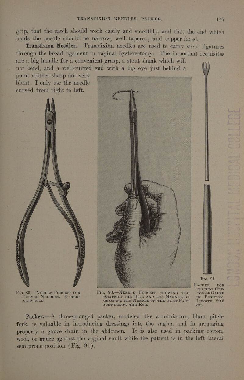 grip, that the catch should work easily and smoothly, and that the end which holds the needle should be narrow, well tapered, and copper-faced. Transfixion Needles.—Transfixion needles are used to earry stout ligatures through the broad hgament in vaginal hysterectomy. The important requisites are a big handle for a convenient grasp, a stout shank which will not bend, and a well-curved end with a big eye just behind a point neither sharp nor very blunt. I only use the needle curved from right to left. Fie. 91. : PACKER FOR PLACING CoT- Fic. 89.—NEEDLE FORCEPS FOR Fic. 90.—NEEDLE FORCEPS SHOWING THE TON ORGAUZE CuRVED NEEDLES. #2 ORDI- SHAPE OF THE BITE AND THE MANNER OF IN POSITION. 3 NARY SIZE. GRASPING THE NEEDLE ON THE FLAT Part LeEnern, 20.5 JUST BELOW THE EYE. CM. Packer.—A three-pronged packer, modeled like a miniature, blunt pitch- fork, is valuable in introducing dressings into the vagina and in arranging properly a gauze drain in the abdomen. It is also used in packing cotton, wool, or gauze against the vaginal vault while the patient is in the left lateral semiprone position (Fig. 91).