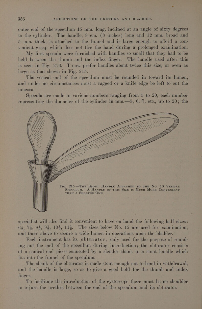 outer end of the speculum 15 mm. long, inclined at an angle of sixty degrees to the cylinder. The handle, 8 em. (3 inches) long and 12 mm. broad and 5 mm. thick, is attached to the funnel and is large enough to afford a con- venient grasp which does not tire the hand during a prolonged examination. My first specula were furnished with handles so small that they had to be held between the thumb and the index finger. The handle used after this is seen in Fig. 216. I now prefer handles about twice this size, or even as large as that shown in Fig. 215. The vesical end of the speculum must be rounded in toward its lumen, and under no circumstances must a ragged or a knife edge be left to cut the mucosa. Specula are made in various numbers ranging from 5 to 20, each number representing the diameter of the cylinder in mm.—5, 6, 7, ete., up to 20; the BS. / Hf, vF s Yi // /y pK / PTL ETY, Fig. 215.—TuHEe Strout HanpLe ATTACHED TO THE No. 10 VESICAL SpEecuLuM. A HANDLE OF THIS SIZE 18 MucH MorE CoNVENIENT THAN A SHORTER ONE. specialist will also find it convenient to have on hand the following half sizes: 64, 74, 84, 94, 104, 114. The sizes below No. 12 are used for examination, and those above to secure a wide lumen in operations upon the bladder. Each instrument has its obturator, only used for the purpose of round- ing out the end of the speculum during introduction; the obturator consists of a conical end piece connected by a slender shank to a stout handle which fits into the funnel of the speculum. The shank of the obturator is made stout enough not to bend in withdrawal, and the handle is large, so as to give a good hold for the thumb and index finger. : To facilitate the introduction of the cystosecope there must be no shoulder to injure the urethra between the end of the speculum and its obturator.