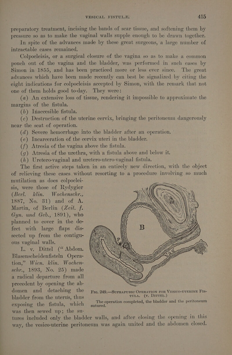 preparatory treatment, incising the bands of scar tissue, and softening them by pressure so as to make the vaginal walls supple enough to be drawn together. In spite of the advances made by these great surgeons, a large number of intractable cases remained. Colpocleisis, or a surgical closure of the vagina so as to make a common pouch out of the vagina and the bladder, was performed in such cases by Simon in 1855, and has been practiced more or less ever since. The great advances which have been made recently can best be signalized by citing the eight indications for colpocleisis accepted by Simon, with the remark that not one of them holds good to-day. They were: (a) An extensive loss of tissue, rendering it impossible to approximate the margins of the fistula. (b) Inaccesible fistula. (c) Destruction of the uterine cervix, bringing the peritoneum dangerously . near the seat of operation. (d) Severe hemorrhage into the bladder after an operation. (e) Incarceration of the cervix uteri in the bladder. (f) Atresia of the vagina above the fistula. (q) Atresia of the urethra, with a fistula above and below it. (h) Uretero-vaginal and uretero-utero-vaginal fistula. The first. active steps taken in an entirely new direction, with the object of relieving these cases without resorting to a procedure involving so much mutilation as does colpoclei- 3 sis, were those of Rydygier (Berl. klin. Wochenschr., 1887, No. 31) and of A. Martin, of Berlin (Zeit. f. Gyn. und Geb., 1891), who planned to cover in the de- fect with large flaps dis- sected up from the contigu- ous vaginal walls. Ear, itteli.C“ Abdom: Blasenscheidenfisteln Opera- tion,’ Wien. klin. Wochen- senr., 1893, No. 25) made a radical departure from all precedent by opening the ab- domen and detaching the