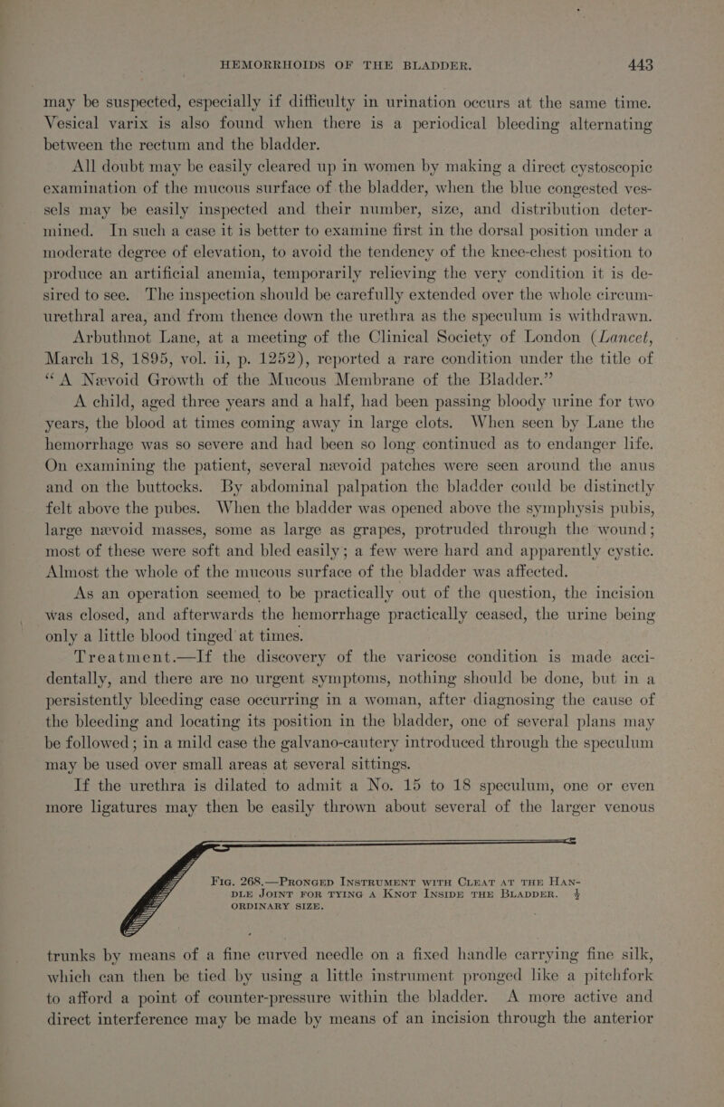 may be suspected, especially if difficulty in urination occurs at the same time. Vesical varix is also found when there is a periodical bleeding alternating between the rectum and the bladder. All doubt may be easily cleared up in women by making a direct cystoscopic examination of the mucous surface of the bladder, when the blue congested ves- sels may be easily inspected and their number, size, and distribution deter- mined. In such a ease it is better to examine first in the dorsal position under a moderate degree of elevation, to avoid the tendency of the knee-chest position to produce an artificial anemia, temporarily relieving the very condition it is de- sired to see. The inspection should be carefully extended over the whole cireum- urethral area, and from thence down the urethra as the speculum is withdrawn. Arbuthnot Lane, at a meeting of the Clinical Society of London (Lancet, March 18, 1895, vol. 11, p. 1252), reported a rare condition under the title of “A Nevoid Growth of the Mucous Membrane of the Bladder.” A child, aged three years and a half, had been passing bloody urine for two years, the blood at times coming away in large clots. When seen by Lane the hemorrhage was so severe and had been so long continued as to endanger life. On examining the patient, several nevoid patches were seen around the anus and on the buttocks. By abdominal palpation the bladder could be distinctly felt above the pubes. When the bladder was opened above the symphysis pubis, large nevoid masses, some as large as grapes, protruded through the wound; most of these were soft and bled easily; a few were hard and apparently cystic. Almost the whole of the mucous surface of the bladder was affected. As an operation seemed to be practically out of the question, the incision was closed, and afterwards the hemorrhage practically ceased, ie urine being only a little blood tinged at times. Treatment.—lIf the discovery of the varicose condition is made acci- dentally, and there are no urgent symptoms, nothing should be done, but in a persistently bleeding case occurring in a woman, after diagnosing the cause of the bleeding and locating its position in the bladder, one of several plans may be followed ; in a mild ease the galvano-cautery introduced through the speculum may be used over small areas at several sittings. If the urethra is dilated to admit a No. 15 to 18 speculum, one or even more ligatures may then be easily thrown about several of the larger venous DLE JOINT FOR TYING A Knot INSIDE THE BLADDER. 4 ORDINARY SIZE. trunks by means of a fine curved needle on a fixed handle carrying fine silk, which can then be tied by using a little instrument pronged like a pitchfork to afford a point of counter-pressure within the bladder. A more active and direct interference may be made by means of an incision through the anterior