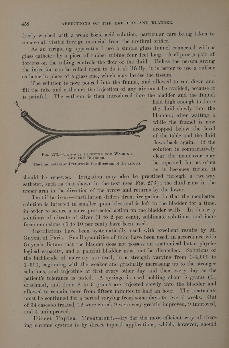 freely washed with a weak boric acid solution, particular care being taken ‘to remove all visible foreign material from the urethral orifice. As an irrigating apparatus I use a simple glass funnel connected with a elass catheter by a piece of rubber tubing four feet long. A clip or a pair of forceps on the tubing controls the flow of the fluid. Unless the person giving the injection can be relied upon to do it skillfully, it is better to use a rubber catheter in place of a glass one, which may bruise the tissues. ; The solution is now poured into the funnel, and allowed to run down and fill the tube and catheter; the injection of any air must be avoided, because it is painful. The catheter is then introduced into the bladder and the funnel held high enough to force | the fluid slowly into the _ bladder; after waiting a while the funnel is now a dropped below the level of the table and the fluid flows back again. If the solution is comparatively Fic. 273.—Two-way CATHETER FOR WASHING OUT THE BLADDER. clear the maneuver may The fluid enters and returns in the direction of the arrows. be repeated, but as often as it becomes turbid it should be renewed. Irrigation may also be practiced through a two-way catheter, such as that shown in the text (see Fig. 273); the fluid runs in the upper arm in the direction of the arrow and returns by the lower. Tnstillation.—Instillation differs from irrigation in that the medicated solution is injected in smaller quantities and is left in the bladder for a time, in order to secure a more protracted action on the bladder walls. In this way solutions of nitrate of silver (1 to 2 per cent), sublimate solutions, and 1odo- form emulsions (5 to 10 per cent) have been used. Instillations have been systematically used with excellent results by M. Guyon, of Paris. Small quantities of fluid have been used, in accordance with Guyon’s dictum that the bladder does not possess an anatomical but a physio- logical capacity, and a painful bladder must not be distended. Solutions of the bichloride of mercury are used, in a strength varying from 1—4,000 to 1-500, beginning with the weaker and gradually increasing up to the stronger solutions, and injecting at first every other day and then every day as the patient’s tolerance is tested. A syringe is used holding about 5 grams (14 drachms), and from 2 to 5 grams are injected slowly into the bladder and allowed to remain there from fifteen minutes to half an hour. The treatments must be continued for a period varying from some days to several weeks. Out of 34 cases so treated, 12 were cured, 9 were very greatly improved, 9 improved, and 4 unimproved. Direct Topical Treatment.—By far the most efficient way of treat- ing chronic cystitis is by direct topical applications, which, however, should